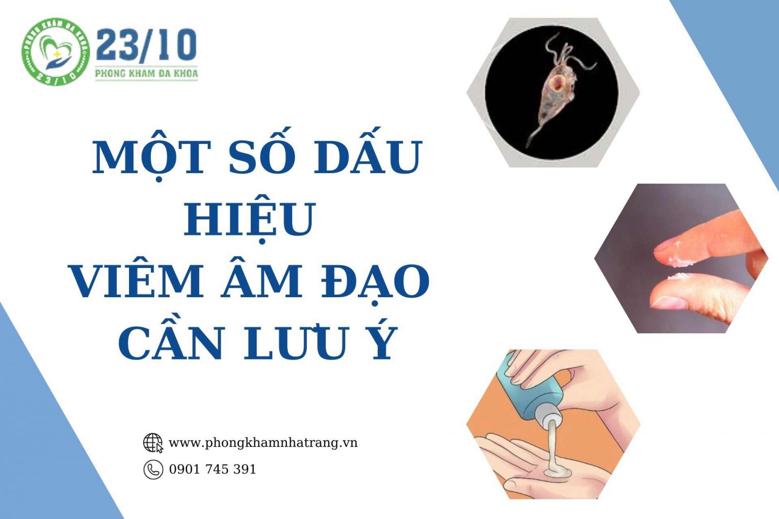 Một số dấu hiệu viêm âm đạo cần lưu ý