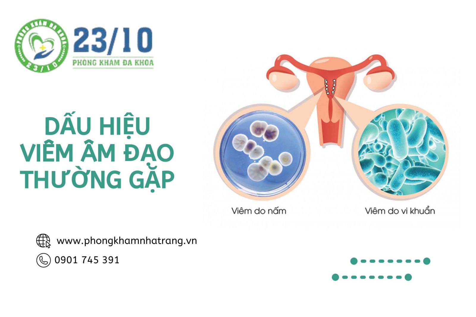 Dấu hiệu viêm âm đạo thường gặp