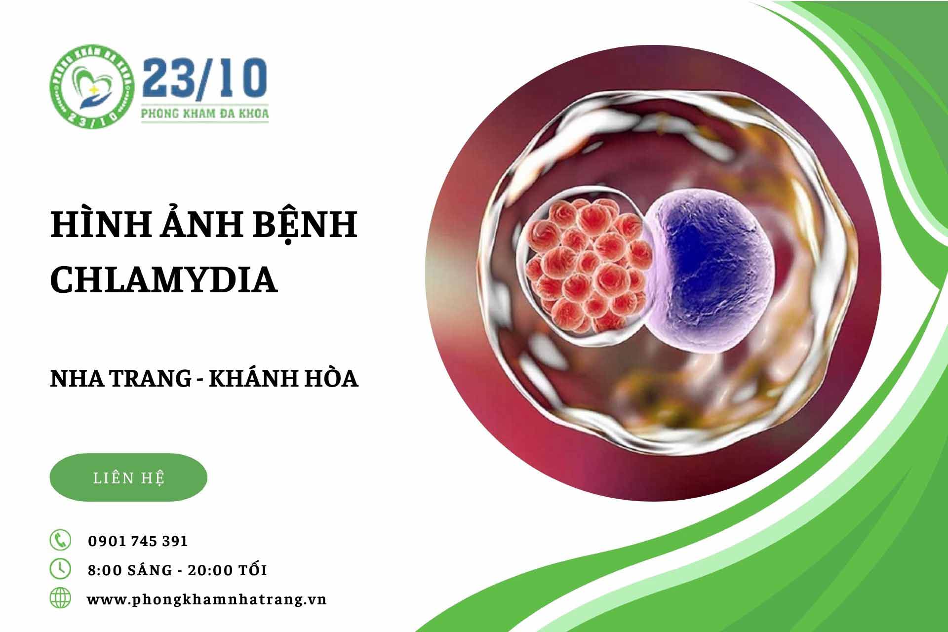 Hình ảnh bệnh chlamydia