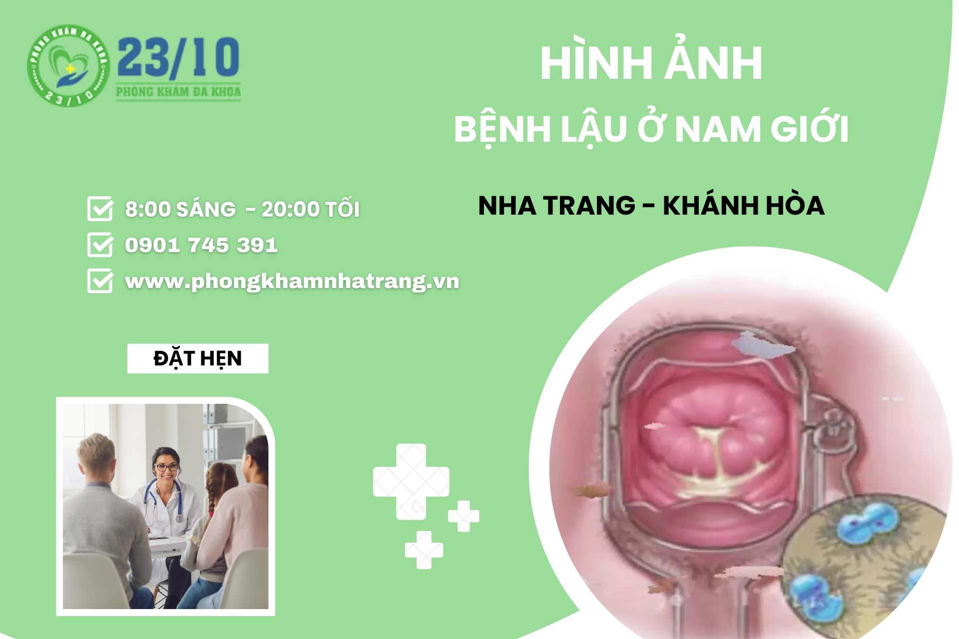 Hình ảnh bệnh lậu ở nam giới