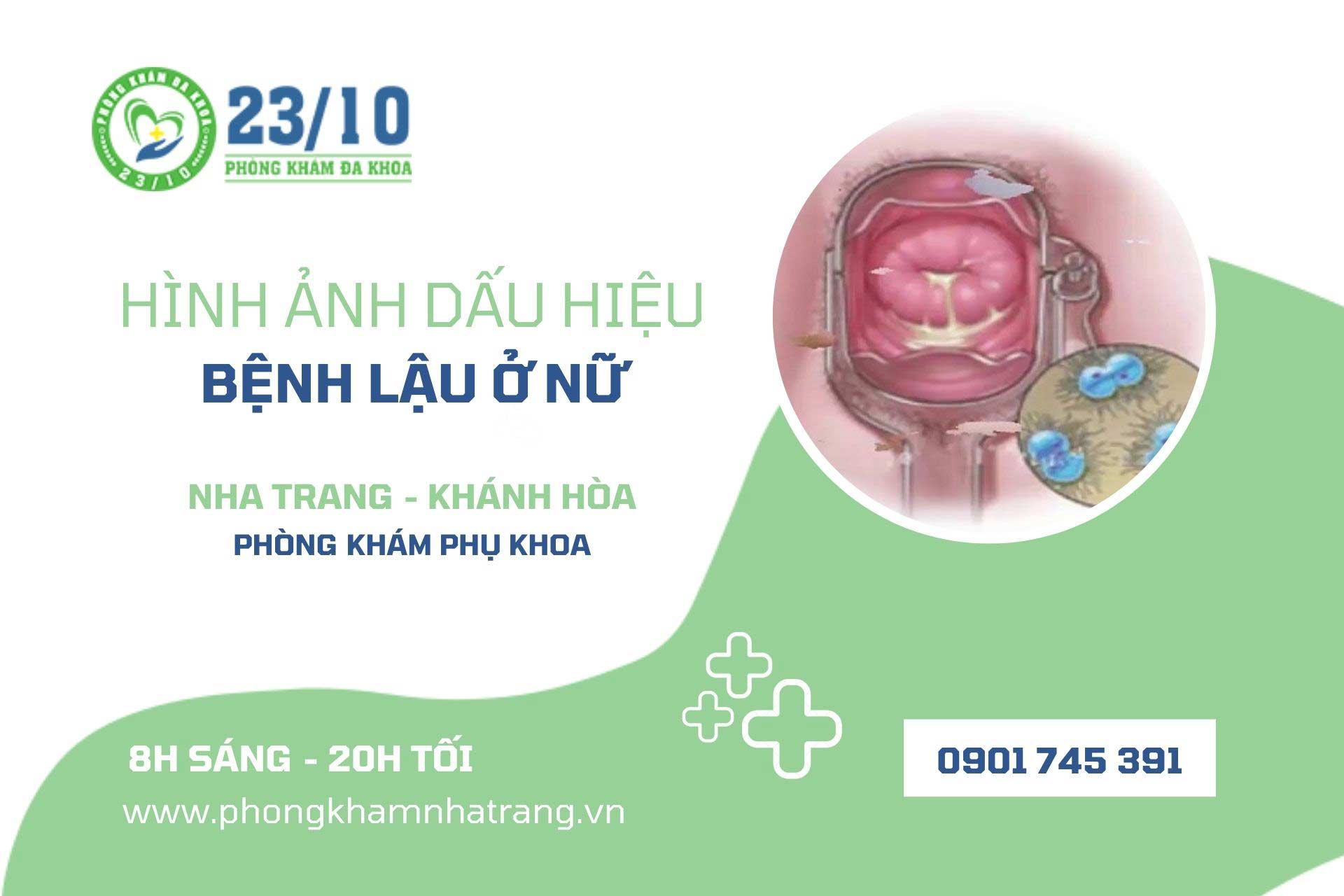 Hình ảnh dấu hiệu bệnh lậu ở nữ