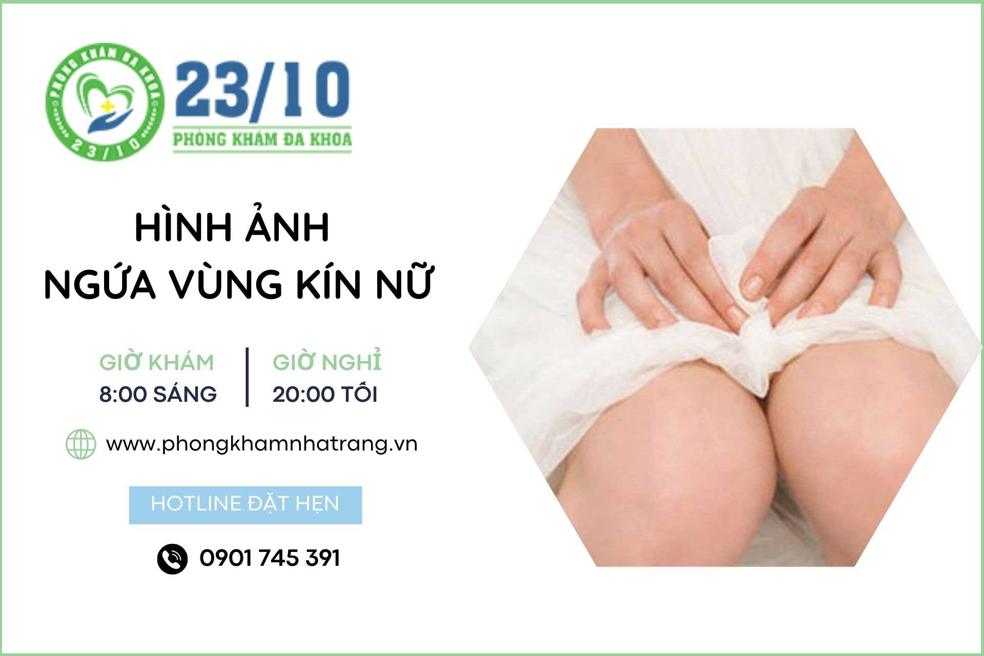 Hình ảnh ngứa vùng kín nữ