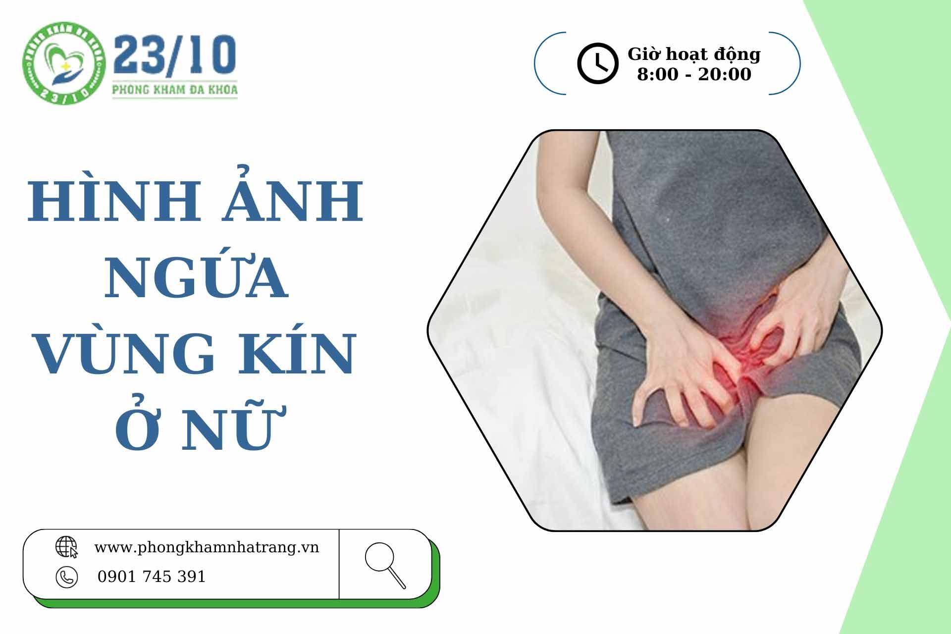 Hình ảnh ngứa vùng kín ở nữ