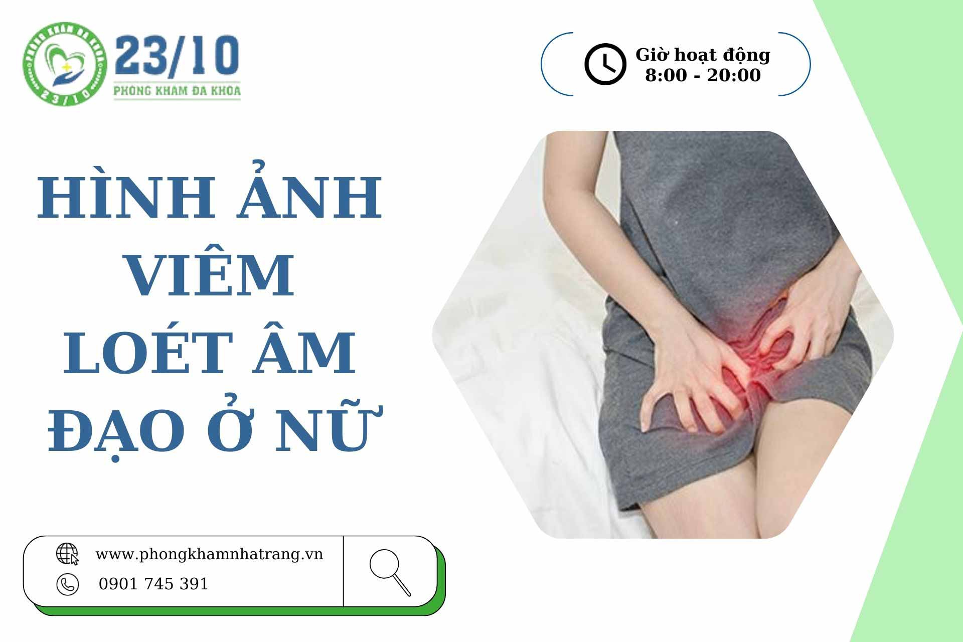 Hình ảnh viêm loét âm đạo ở nữ