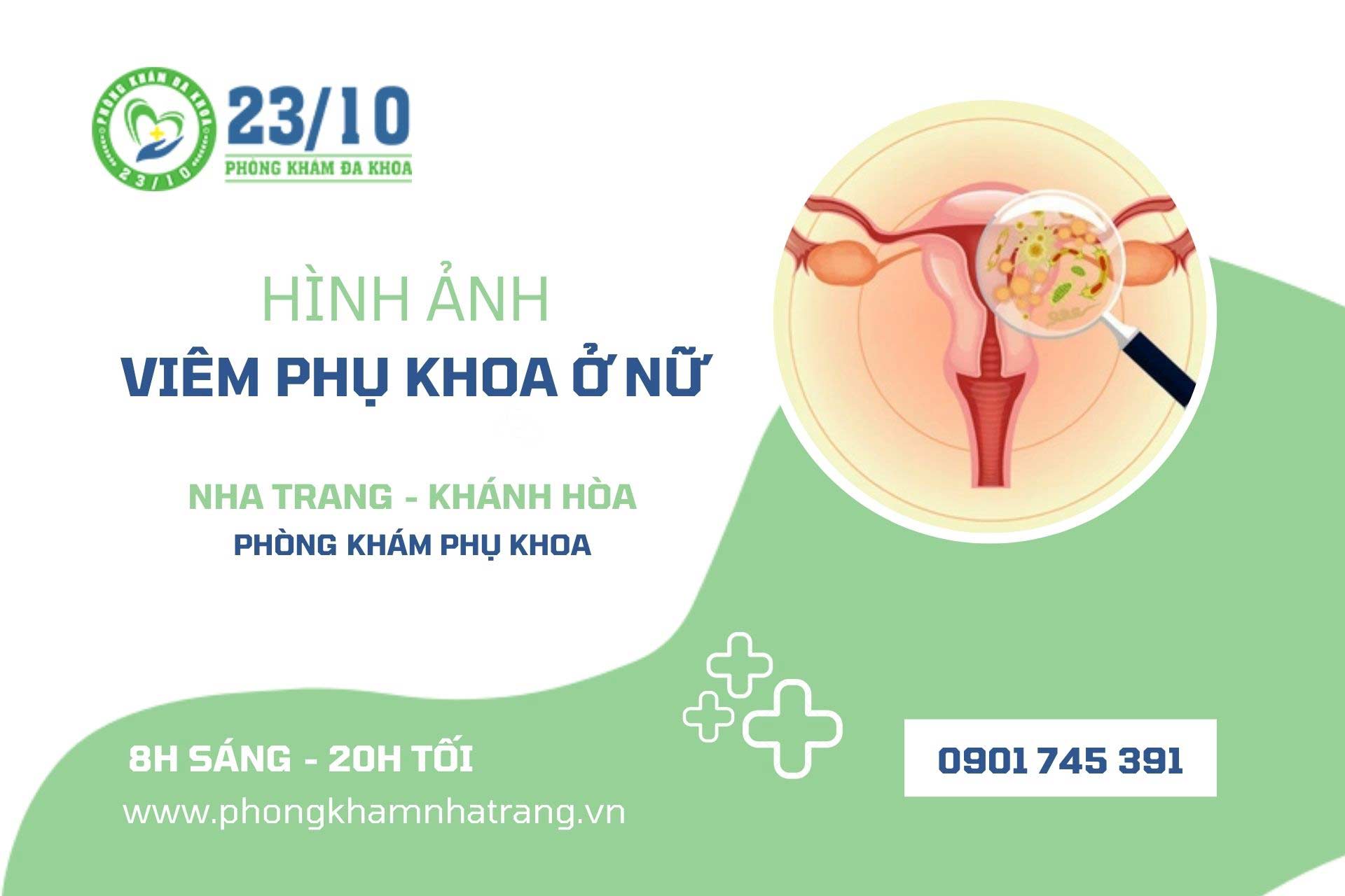 Hình ảnh viêm phụ khoa ở nữ