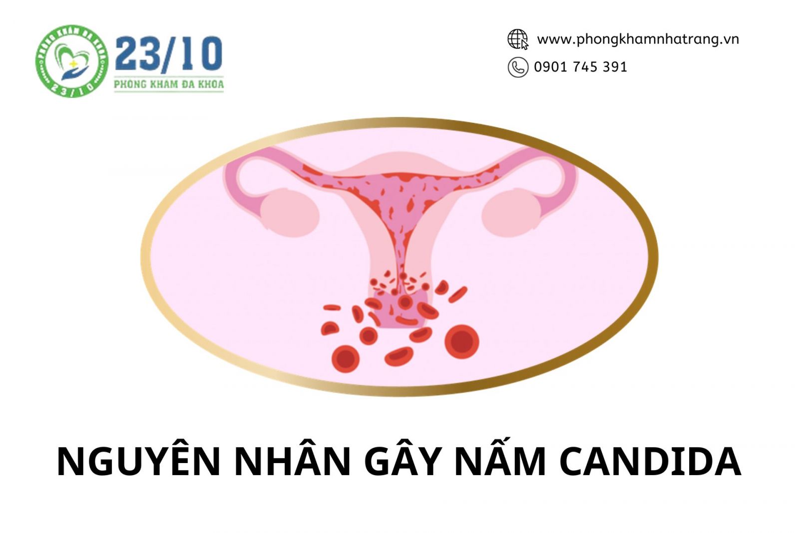 Nguyên nhân gây nấm candida viêm âm đạo