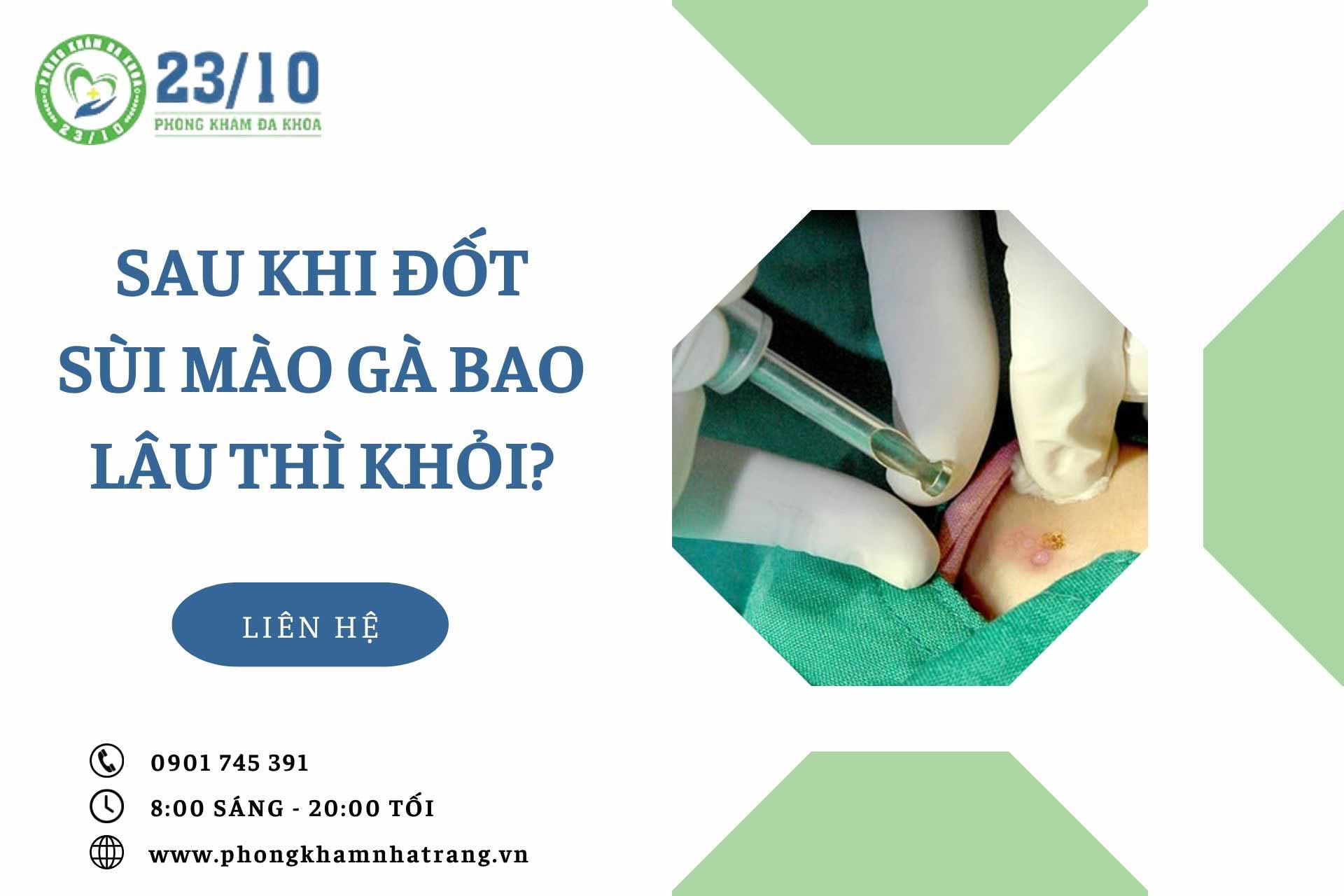 Sau khi đốt sùi mào gà bao lâu thì khỏi?