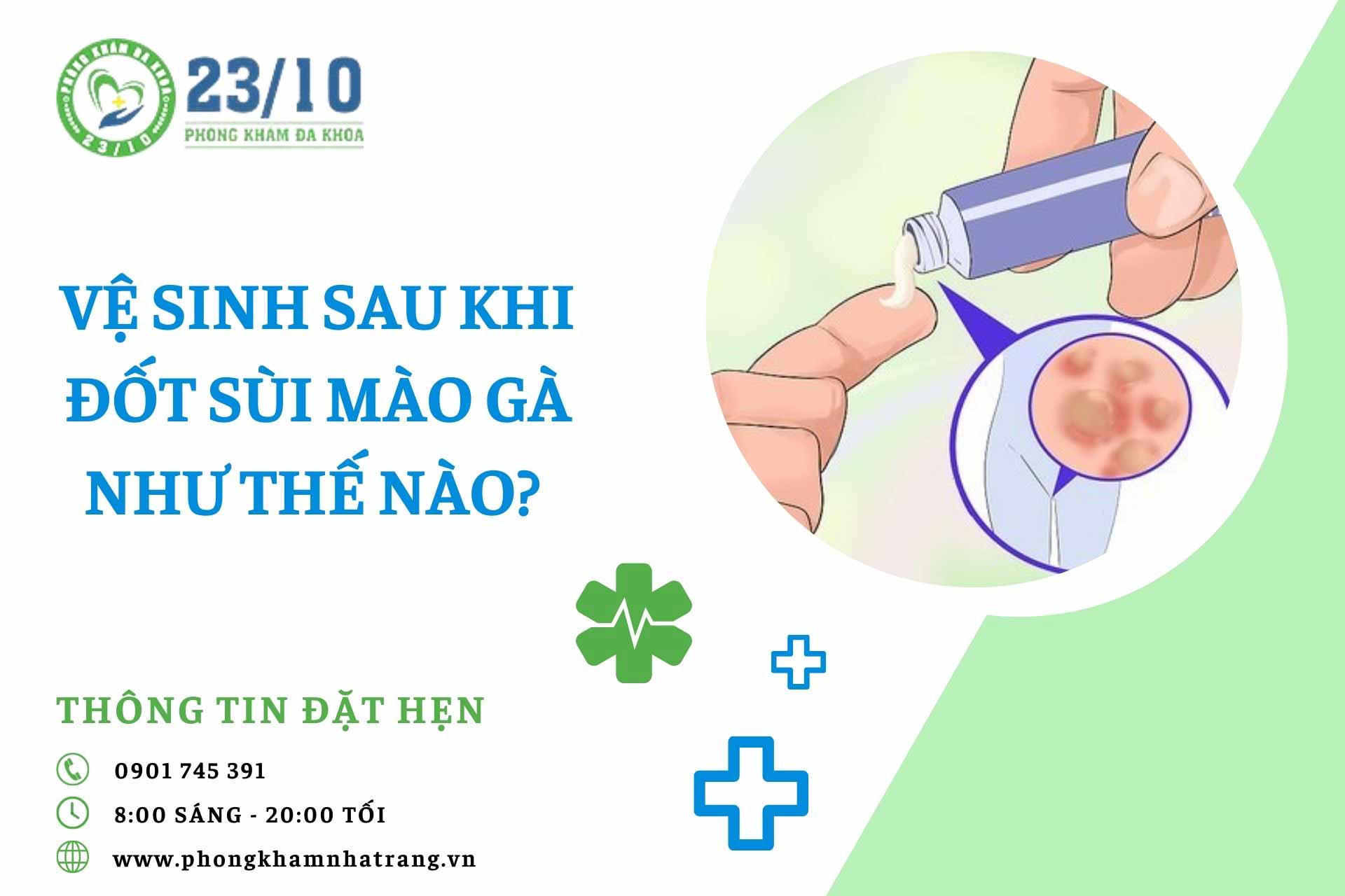 Vệ sinh sau khi đốt sùi mào gà như thế nào?