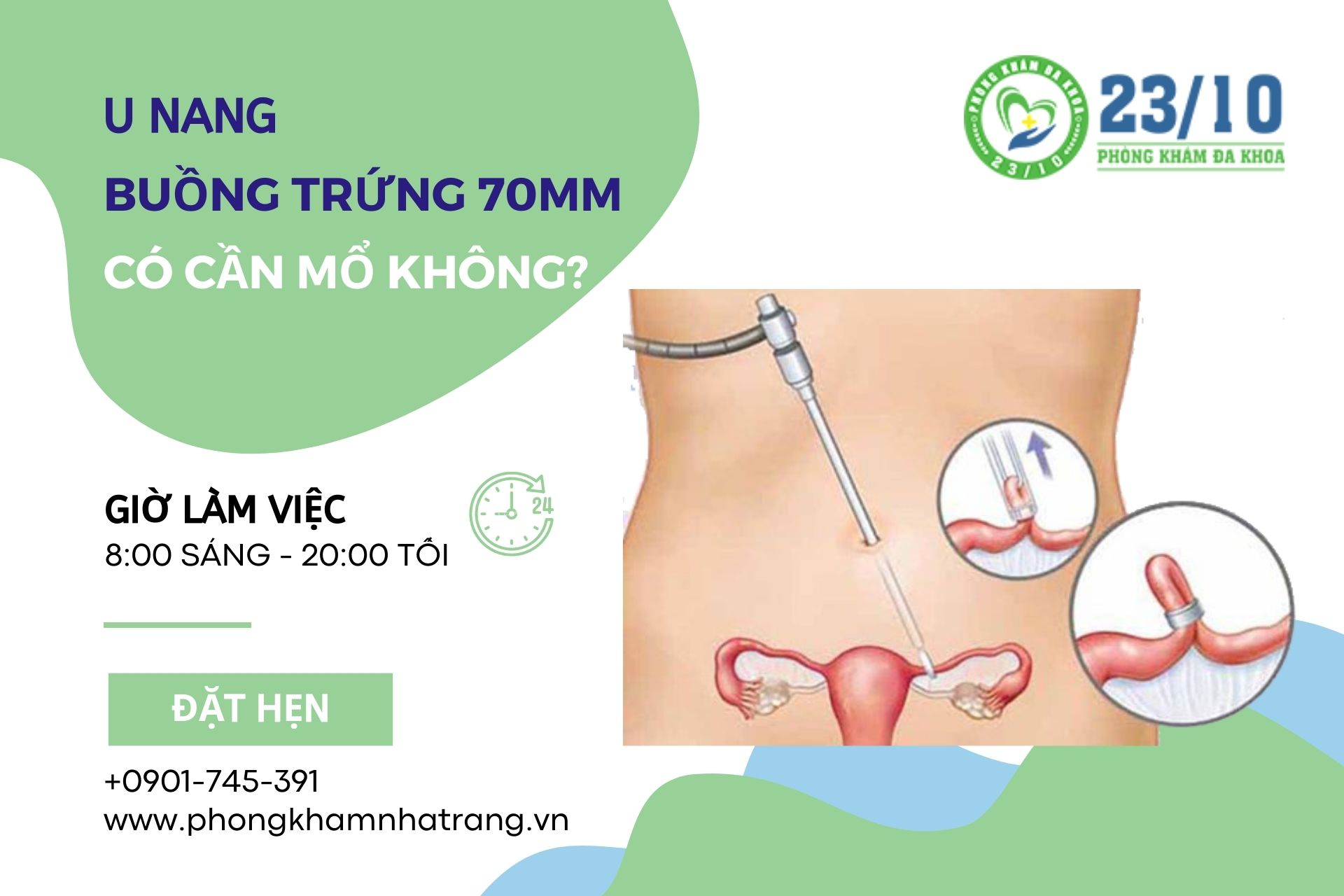 U nang buồng trứng 70mm có cần phải mổ không?