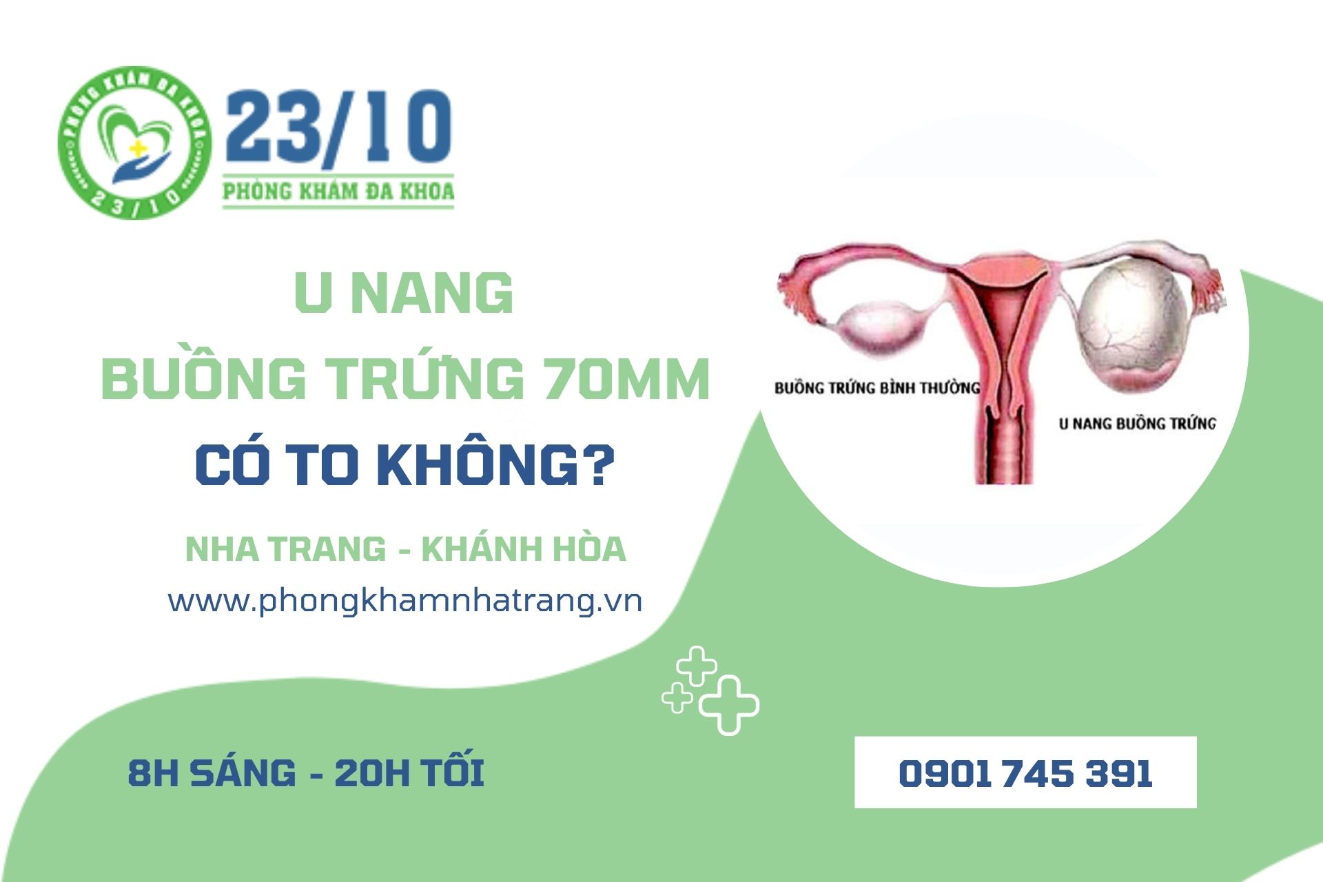 U nang buồng trứng 70mm có phải là to không?