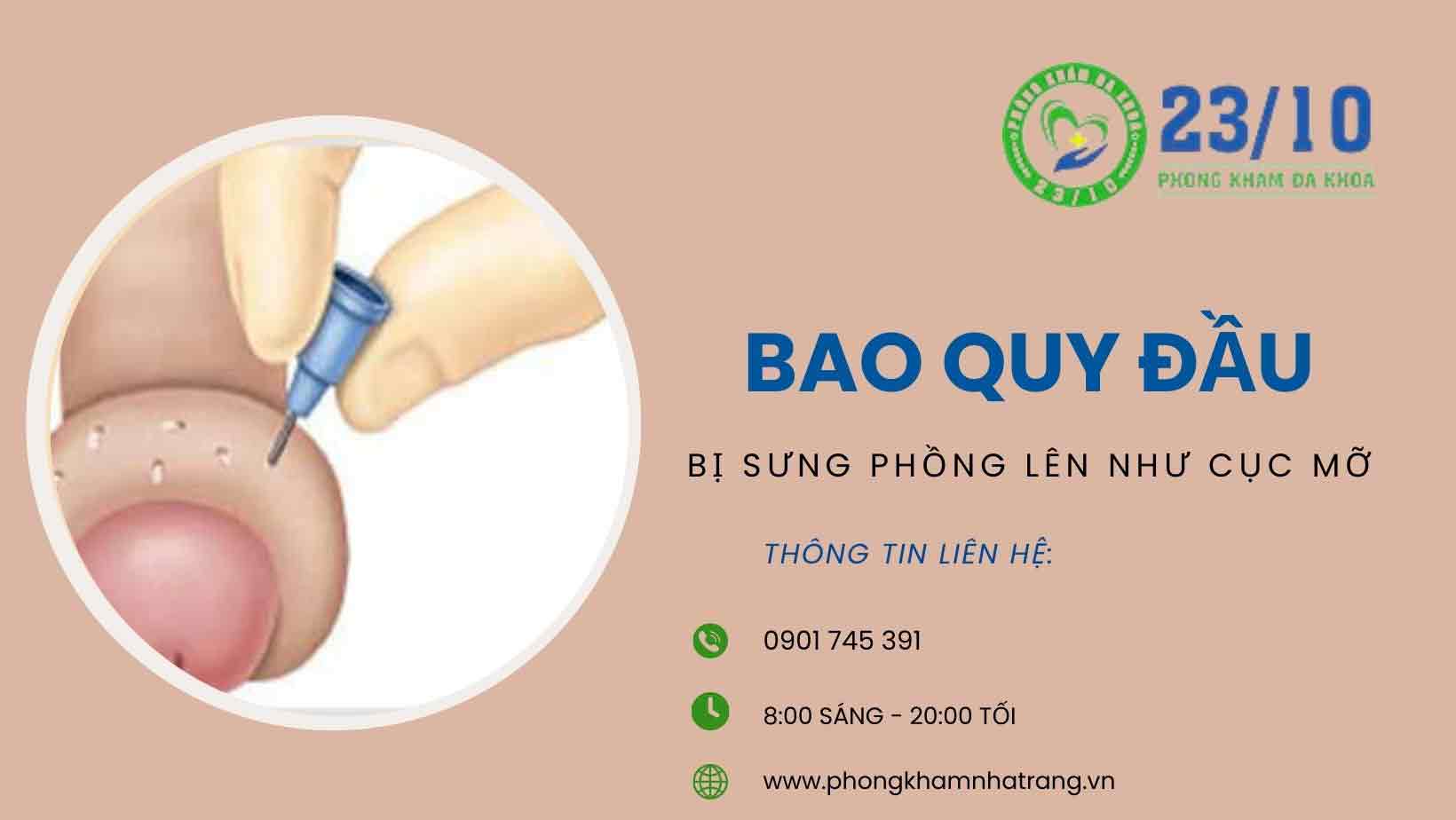 Nguyên nhân khiến bao quy đầu bị sưng phồng lên như cục mỡ