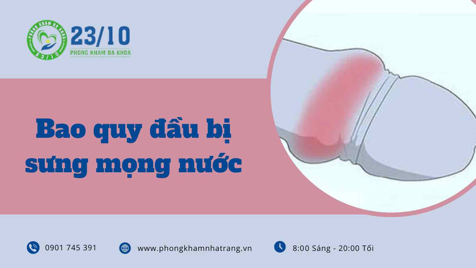 Nguyên nhân gây sưng mọng nước ở bao quy đầu