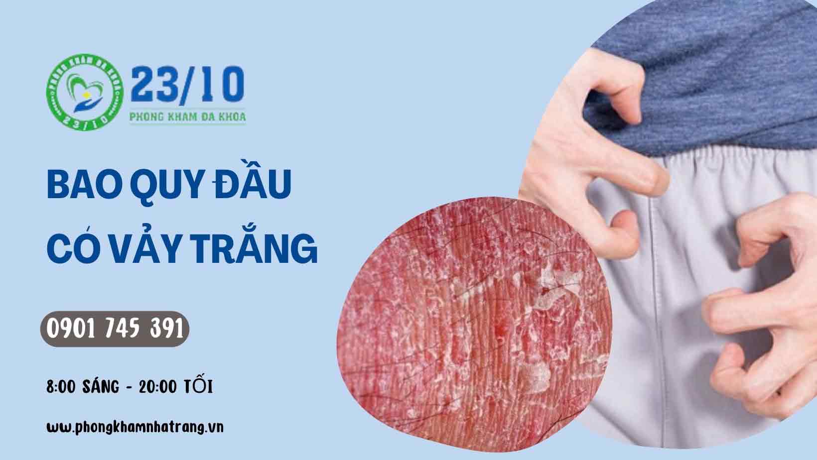 Nguyên nhân gây ra tình trạng bao quy đầu có vảy trắng