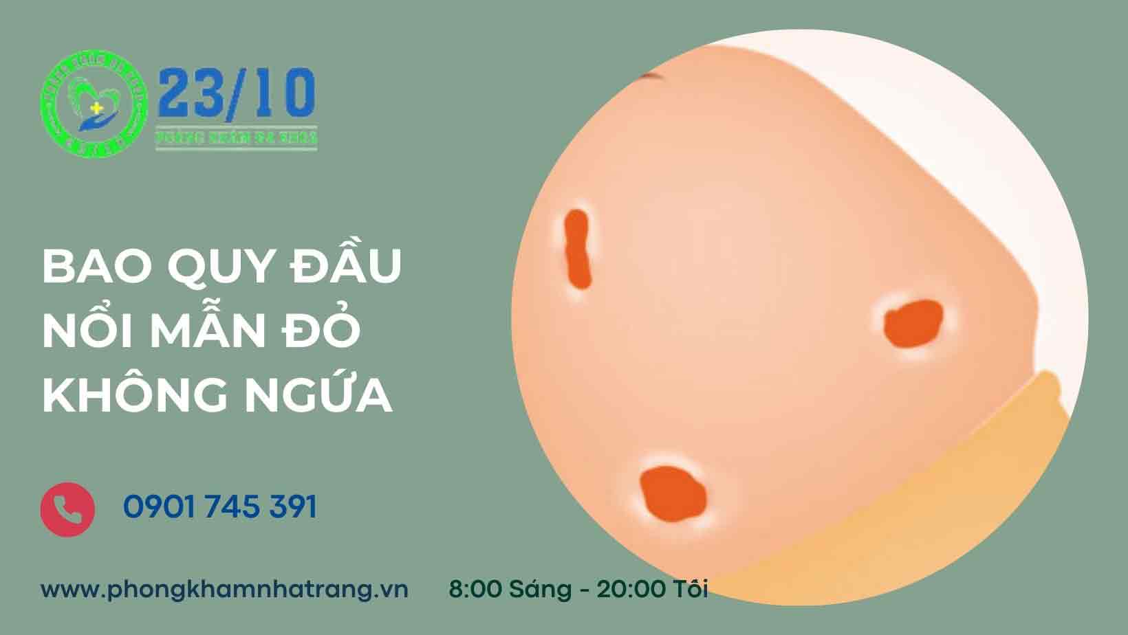 Bao quy đầu nổi mẩn đỏ không ngứa thường do nguyên nhân nào?