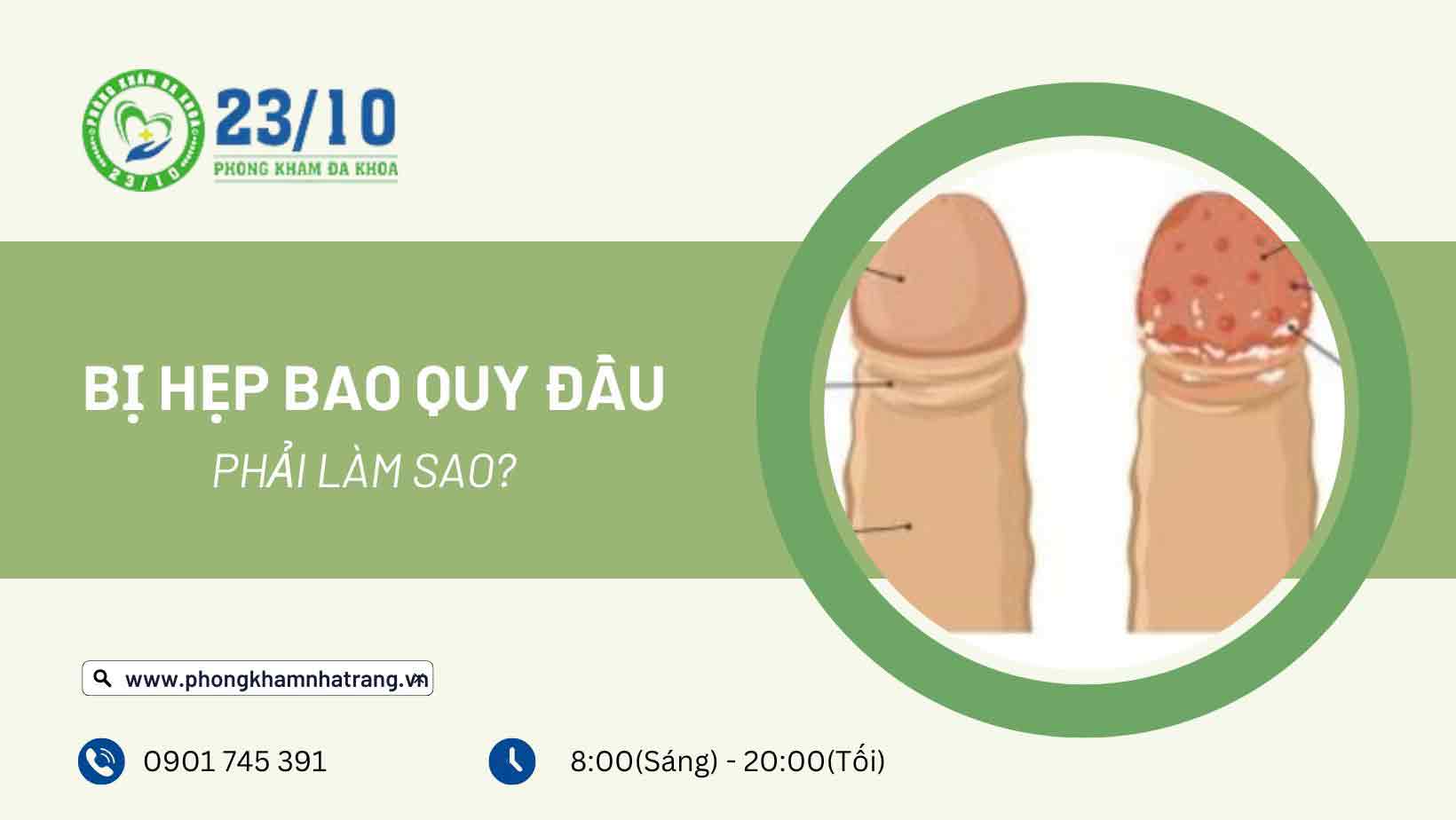 Nguyên nhân gây ra hẹp bao quy đầu