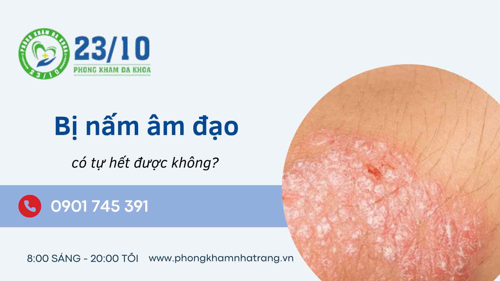 Nguyên nhân gây ra nấm âm đạo