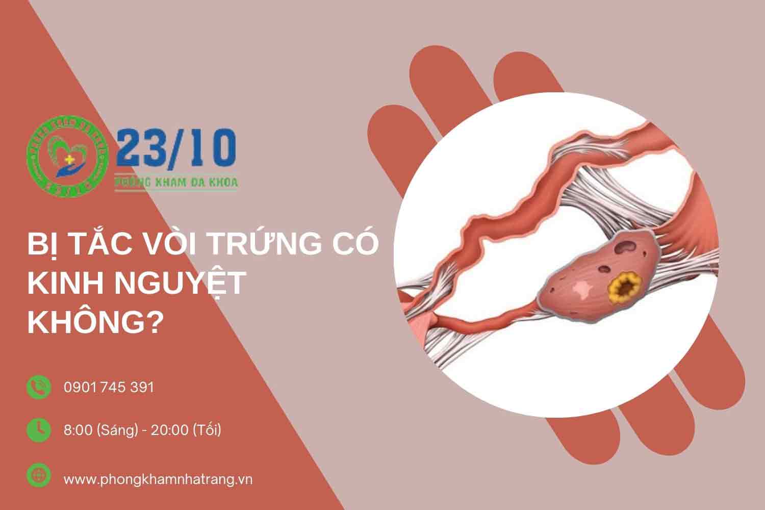 Dấu hiệu tắc vòi trứng ở nữ giới