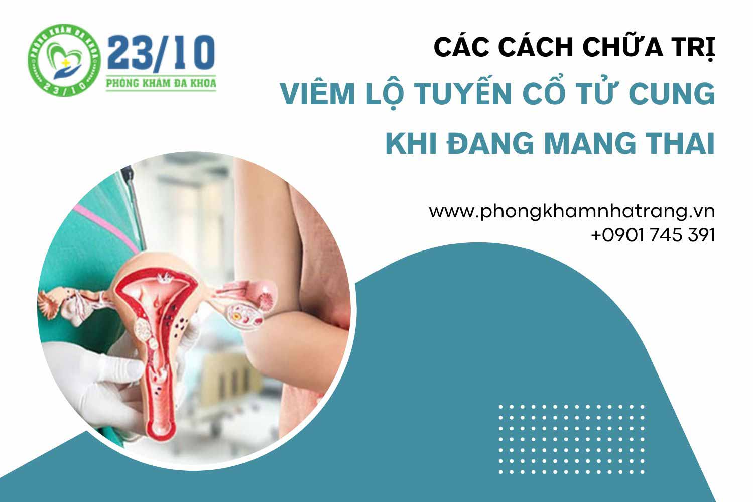 Các phương pháp chữa trị viêm lộ tuyến cổ tử cung khi đang mang thai