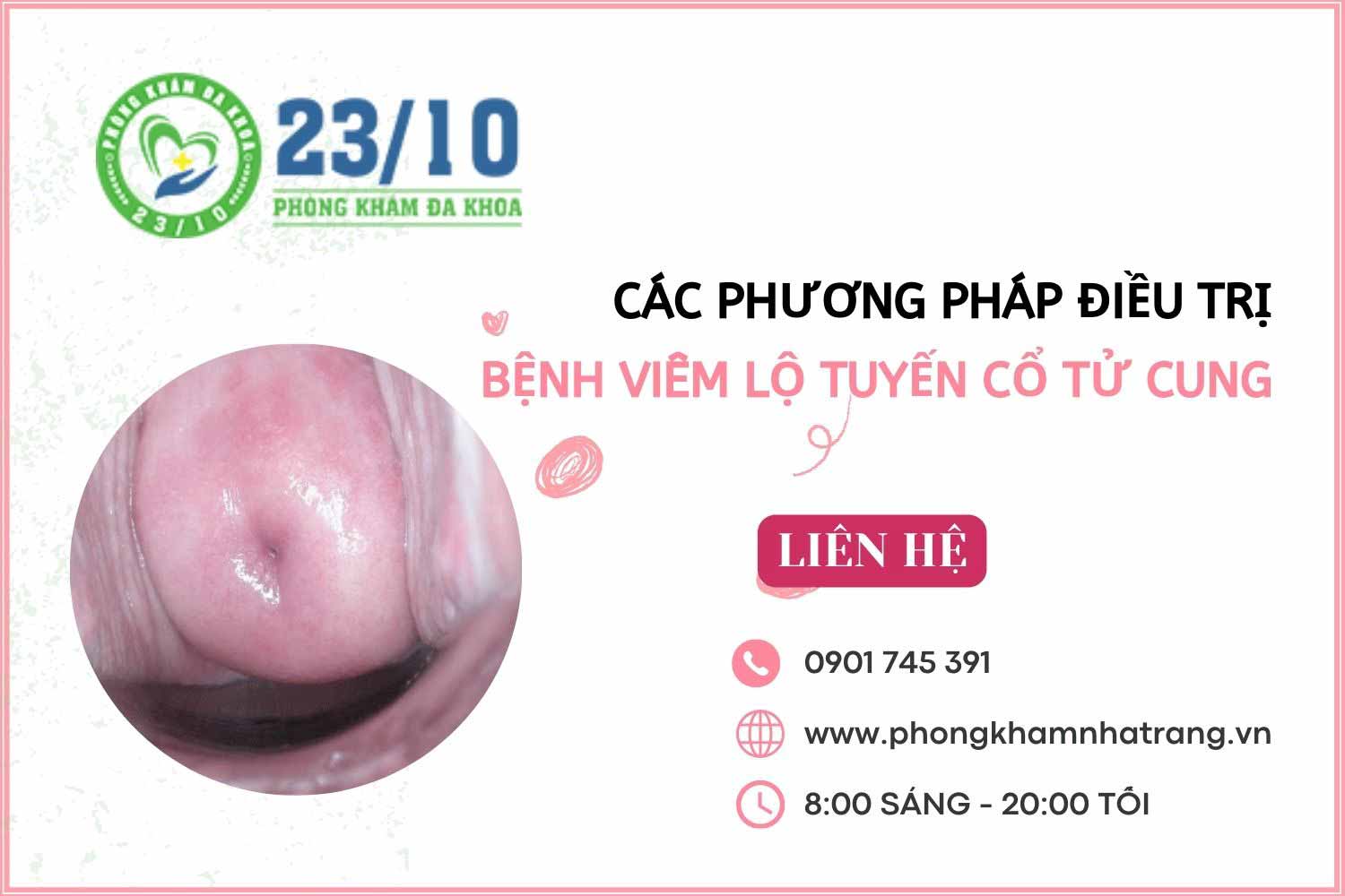 Các phương pháp điều trị bệnh viêm lộ tuyến cổ tử cung hiệu quả