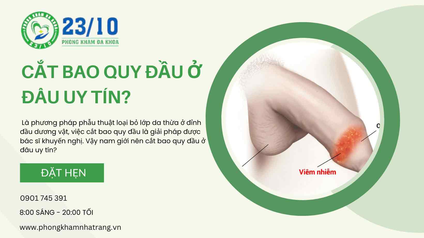 Các tiêu chí để lựa chọn một cơ sở y tế cắt bao quy đầu uy tín
