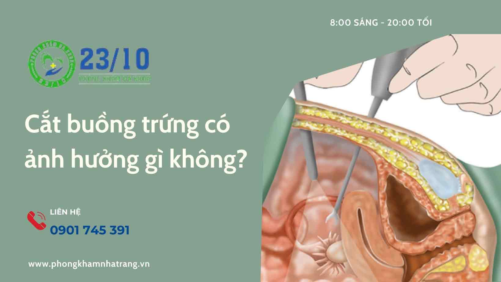 Vì sao phải cắt buồng trứng?