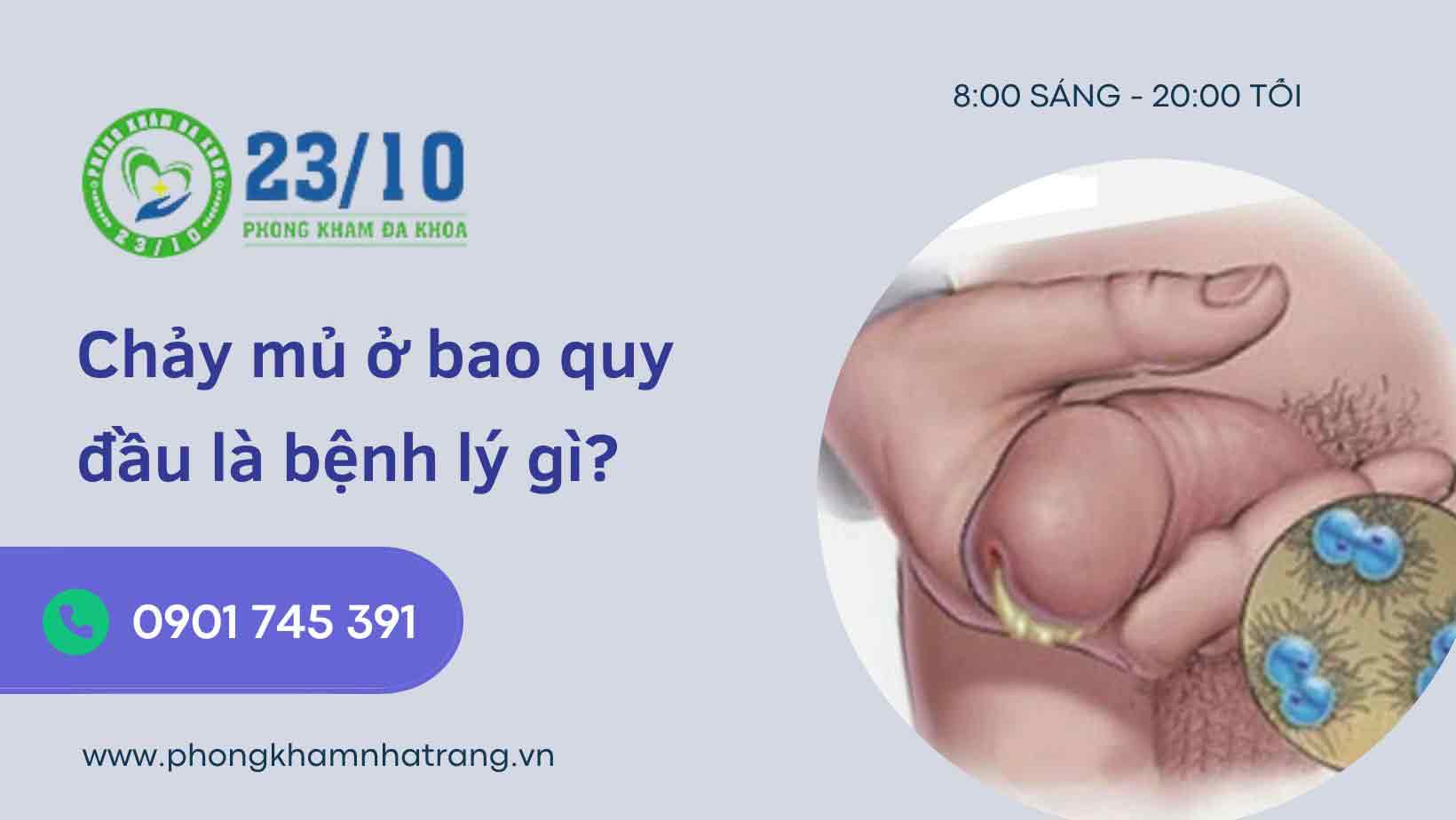 Nguyên nhân gây chảy mủ ở bao quy đầu