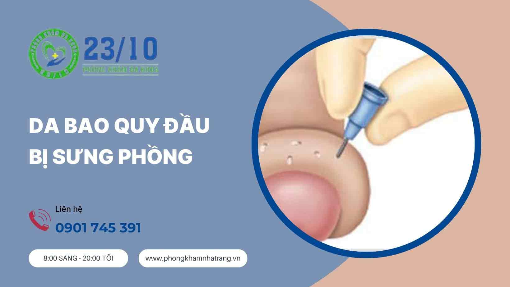 Nguyên nhân gây sưng phồng da bao quy đầu