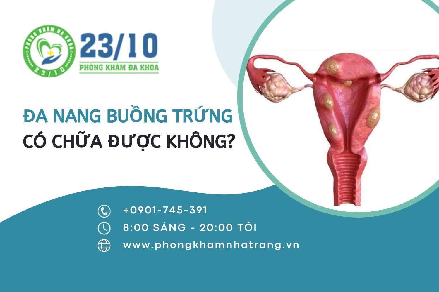 Bệnh đa nang buồng trứng có chữa khỏi được không?