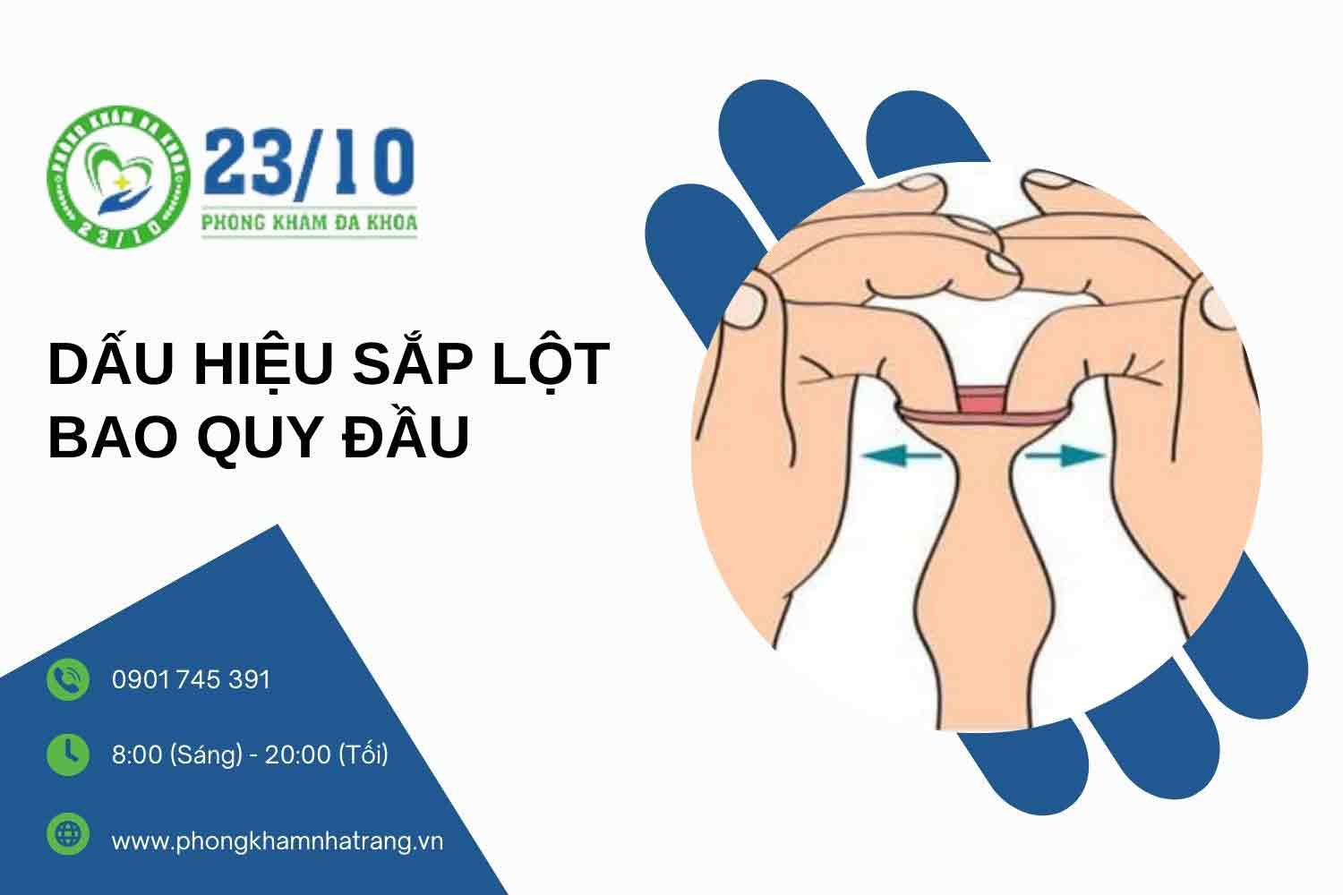 Dấu hiệu sắp lột bao quy đầu ở nam giới