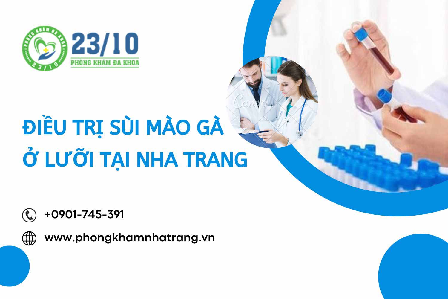 Điều trị sùi mào gà ở nha trang