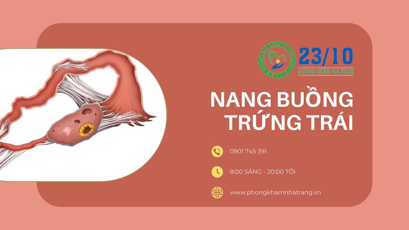 Dấu hiệu u nang buồng trứng trái