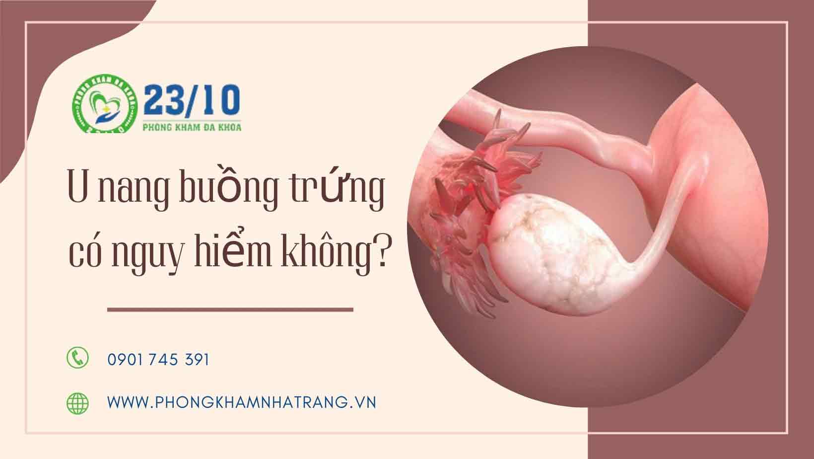 Hình ảnh u nang buồng trứng
