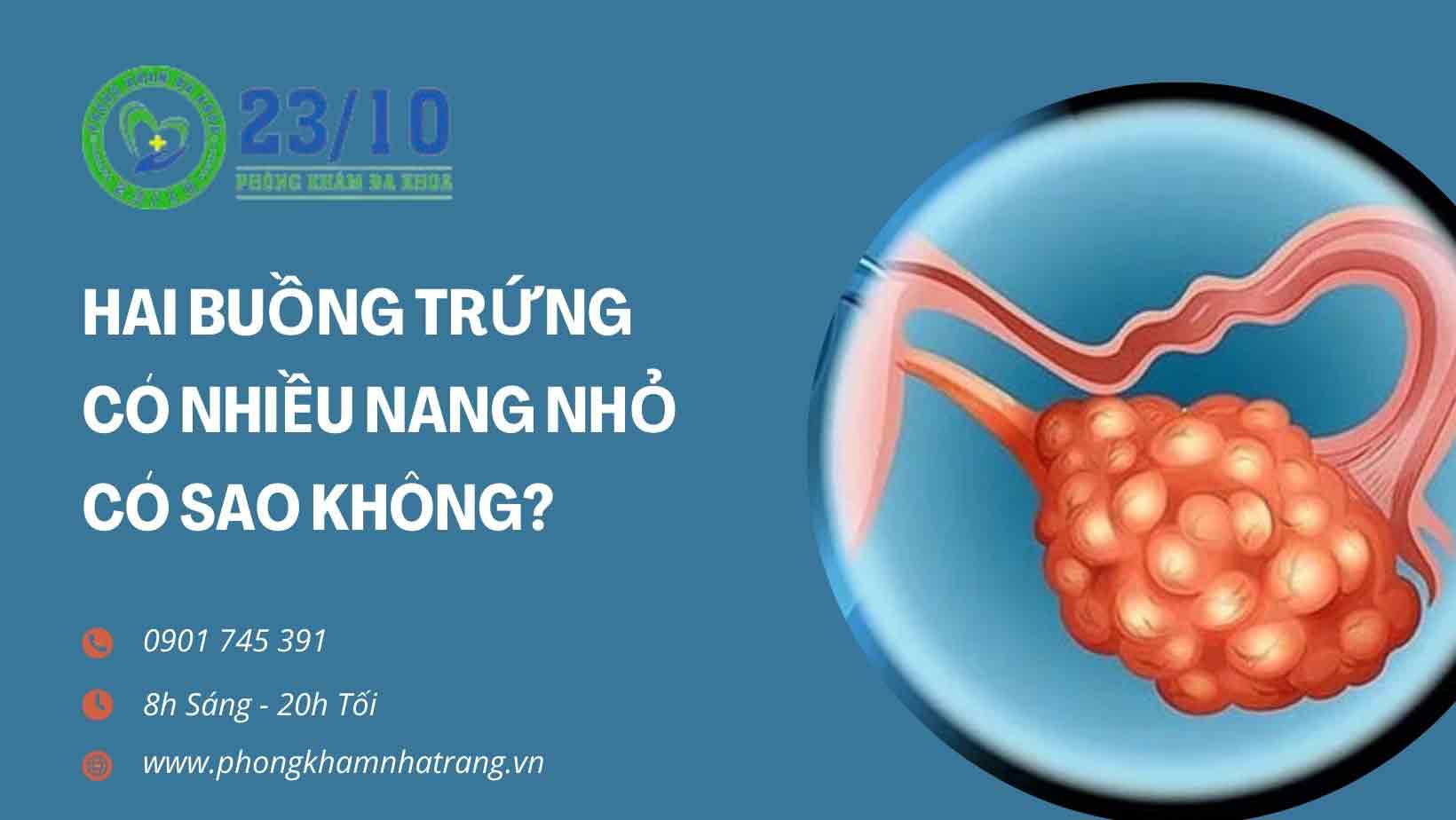 Hình ảnh buồng trứng có nhiều nang nhỏ