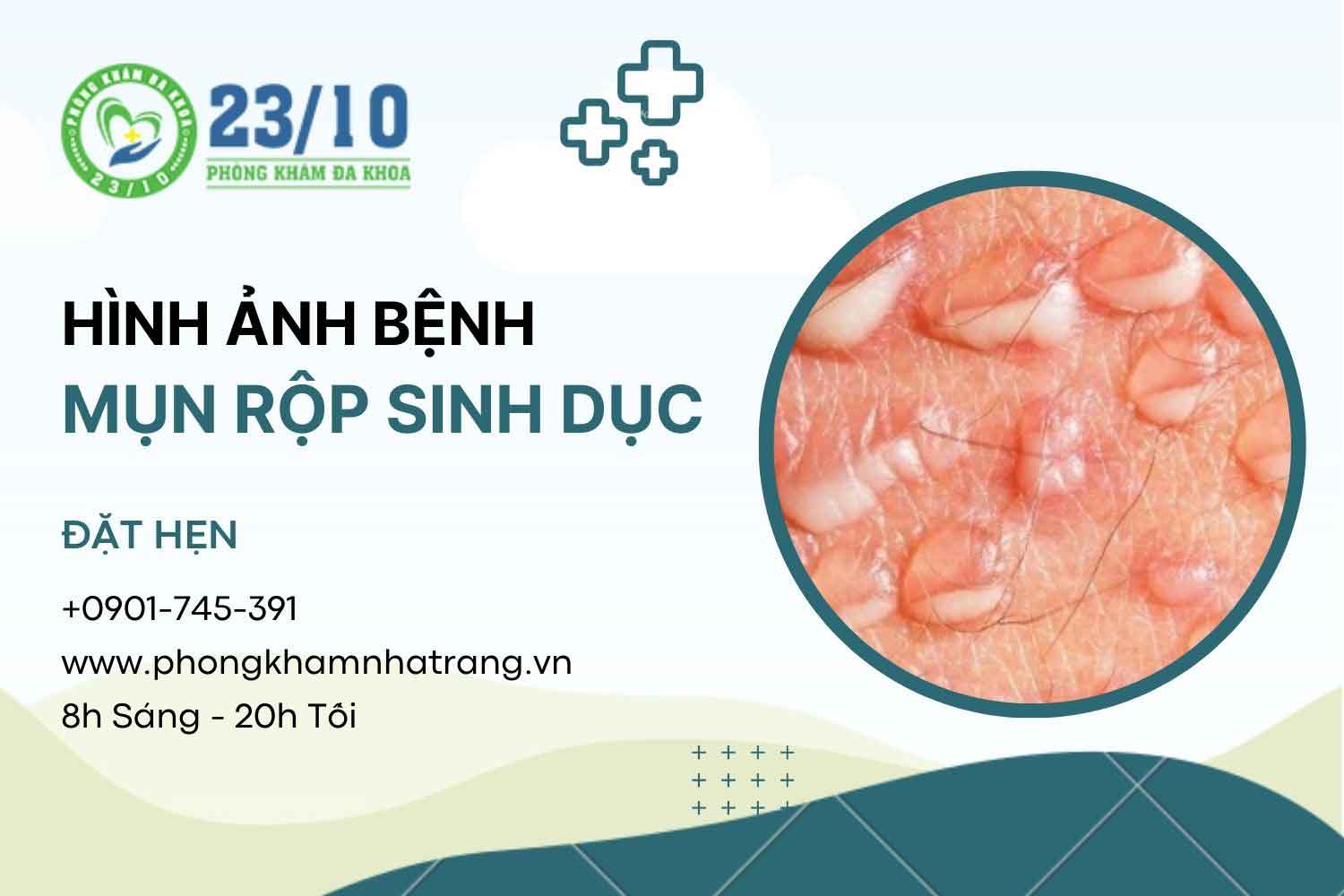 hình ảnh mô tả mụn rộp sinh dục ở cả nam và nữ giai đoạn phát triển bệnh