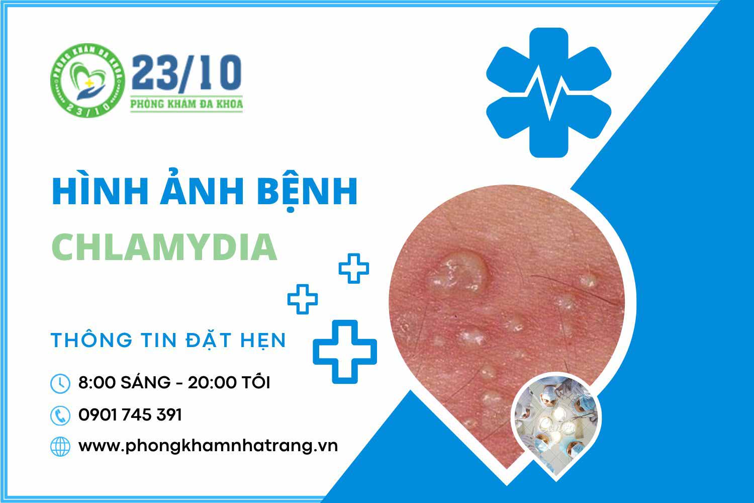 Hình ảnh mô tả triệu chứng do vi khuẩn chlamydia gây ra