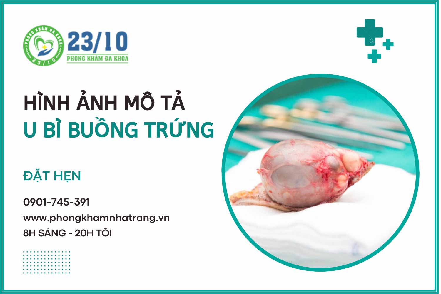 Hình ảnh mô tả người bị u bì buồng trứng