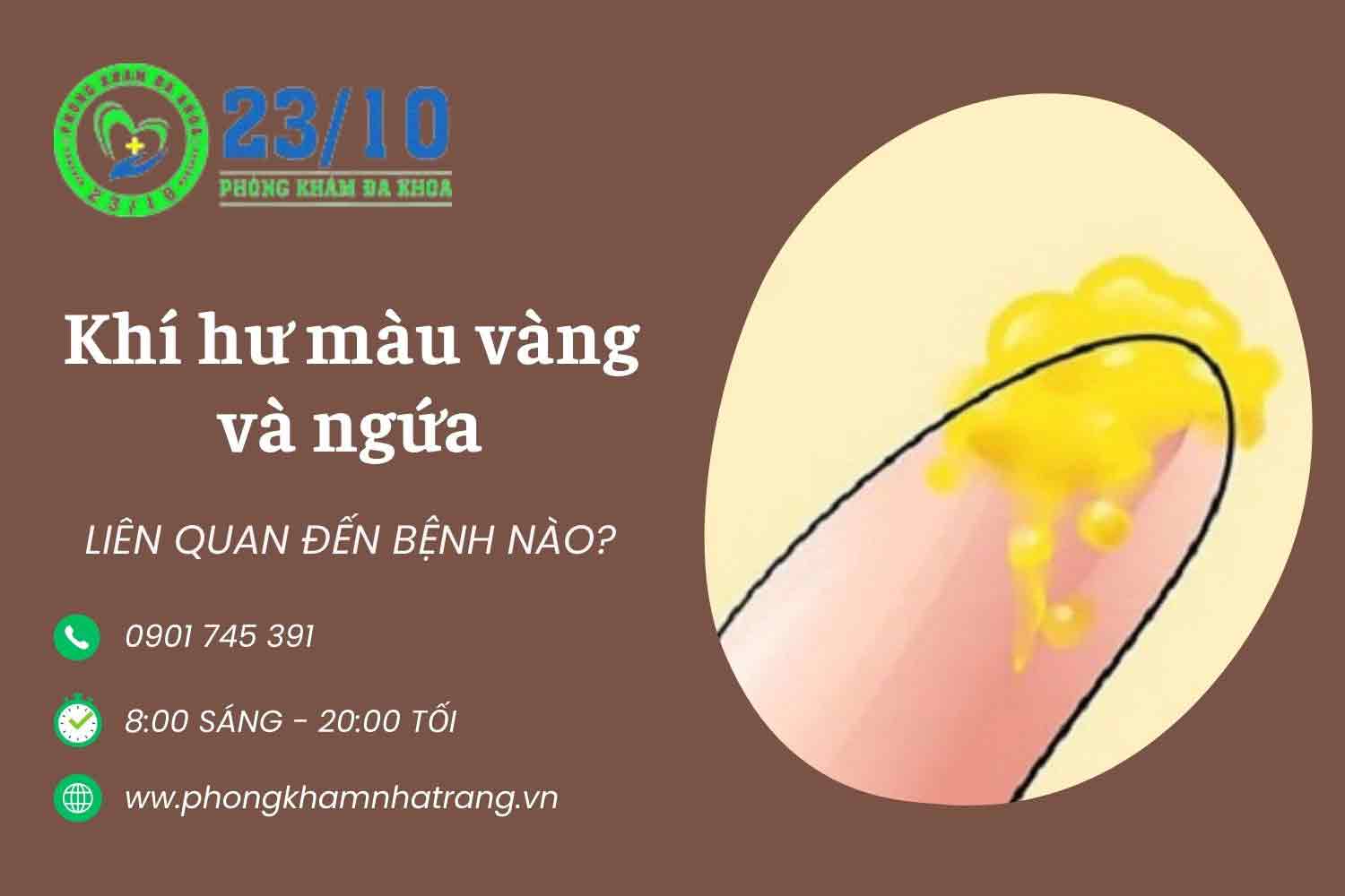 Điều gì gây ra khí hư màu vàng và ngứa?