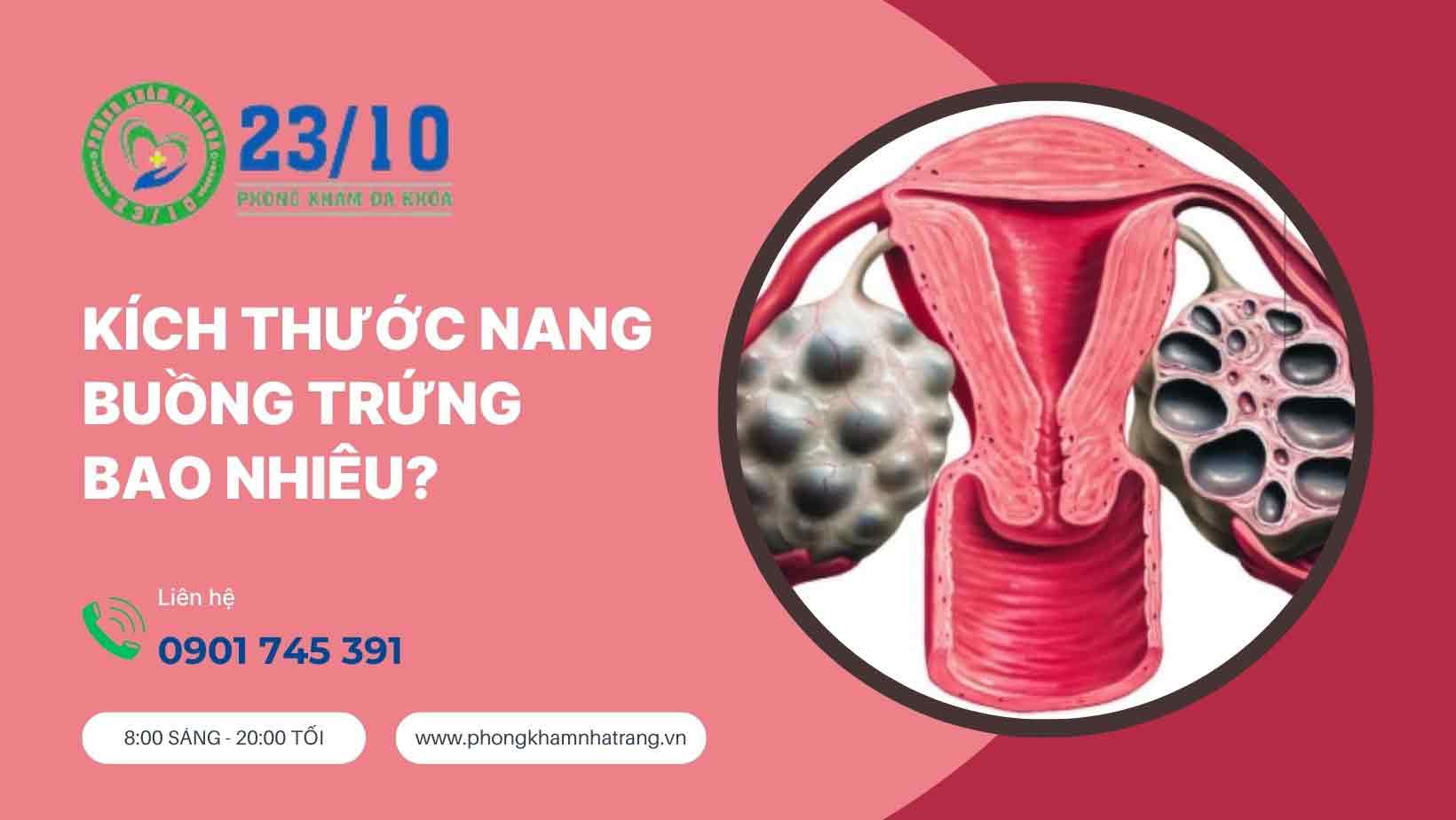 Nang buồng trứng là gì?