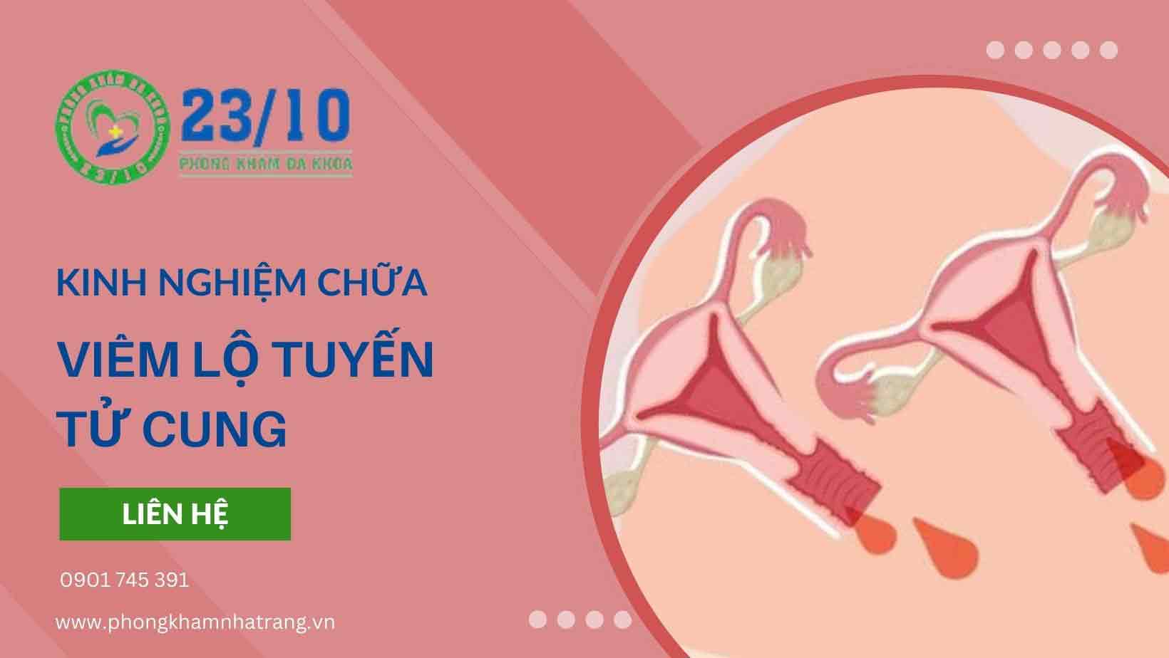 Hình ảnh bệnh viêm lộ tuyến cổ tử cung