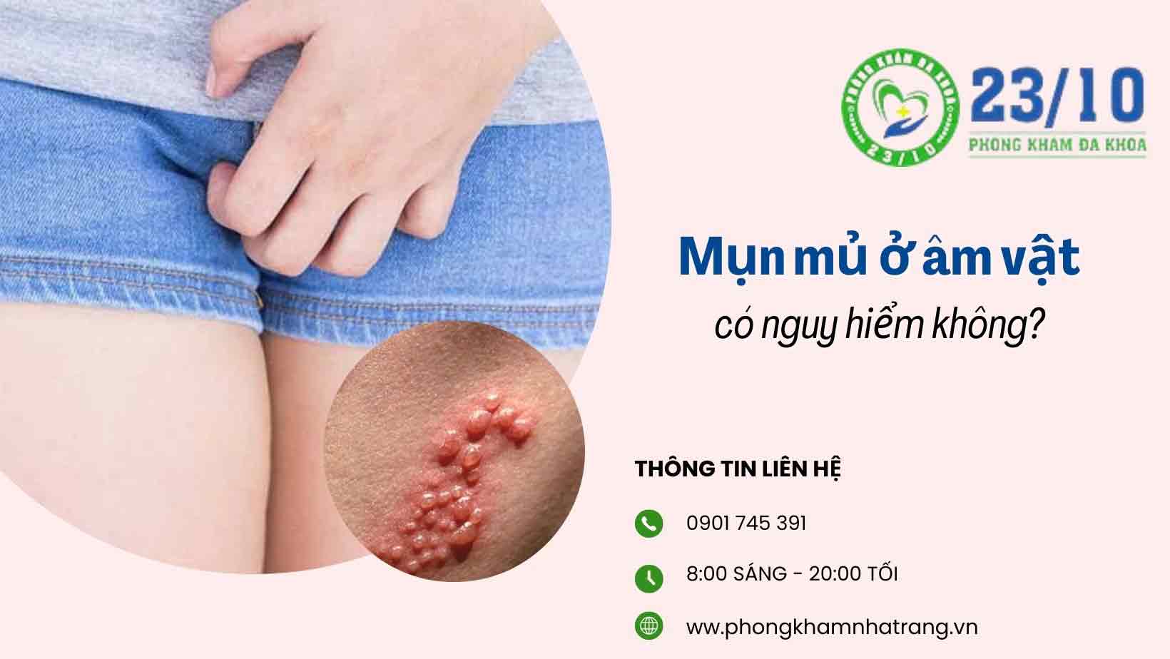 Những nguyên nhân gây mụn mủ ở âm vật