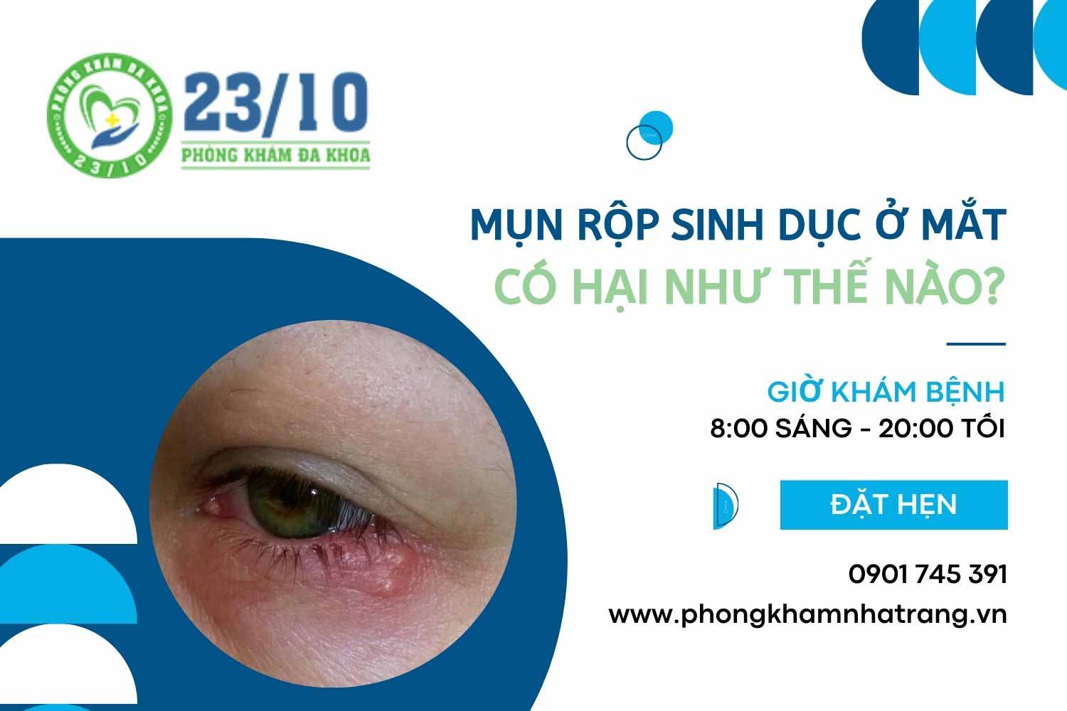 Mụn rộp sinh dục ở mắt 