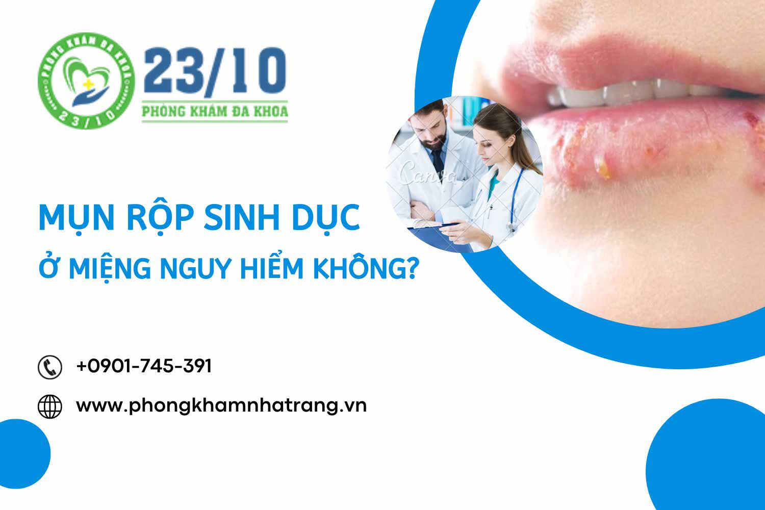 Mụn rộp sinh dục ở miệng 