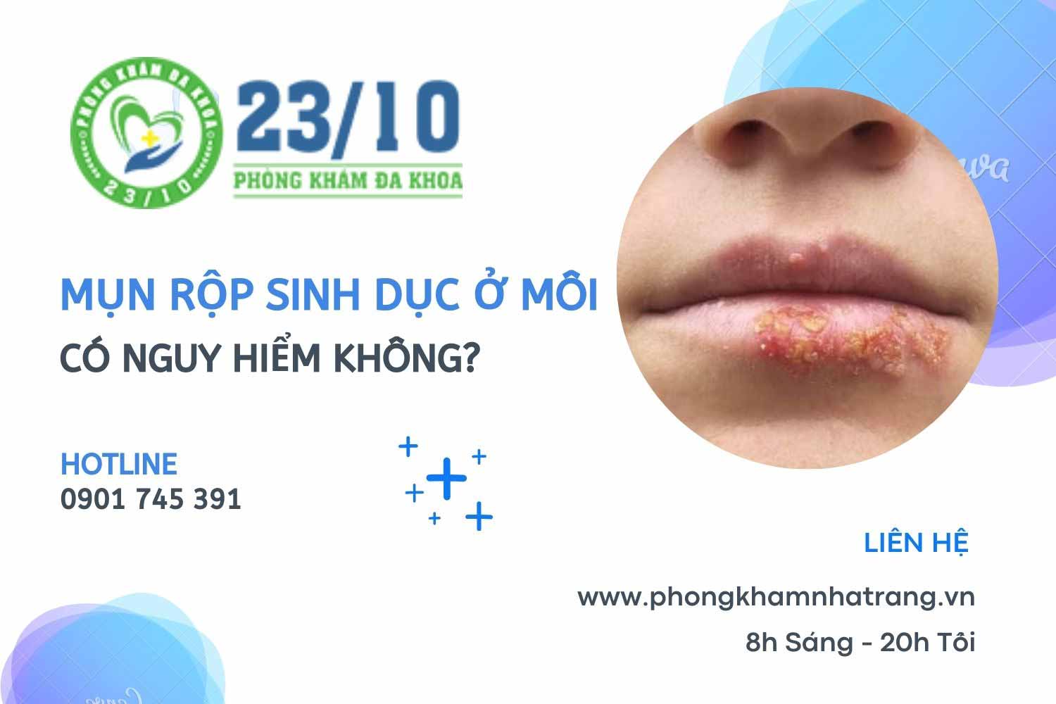 Mụn rộp sinh dục ở môi 