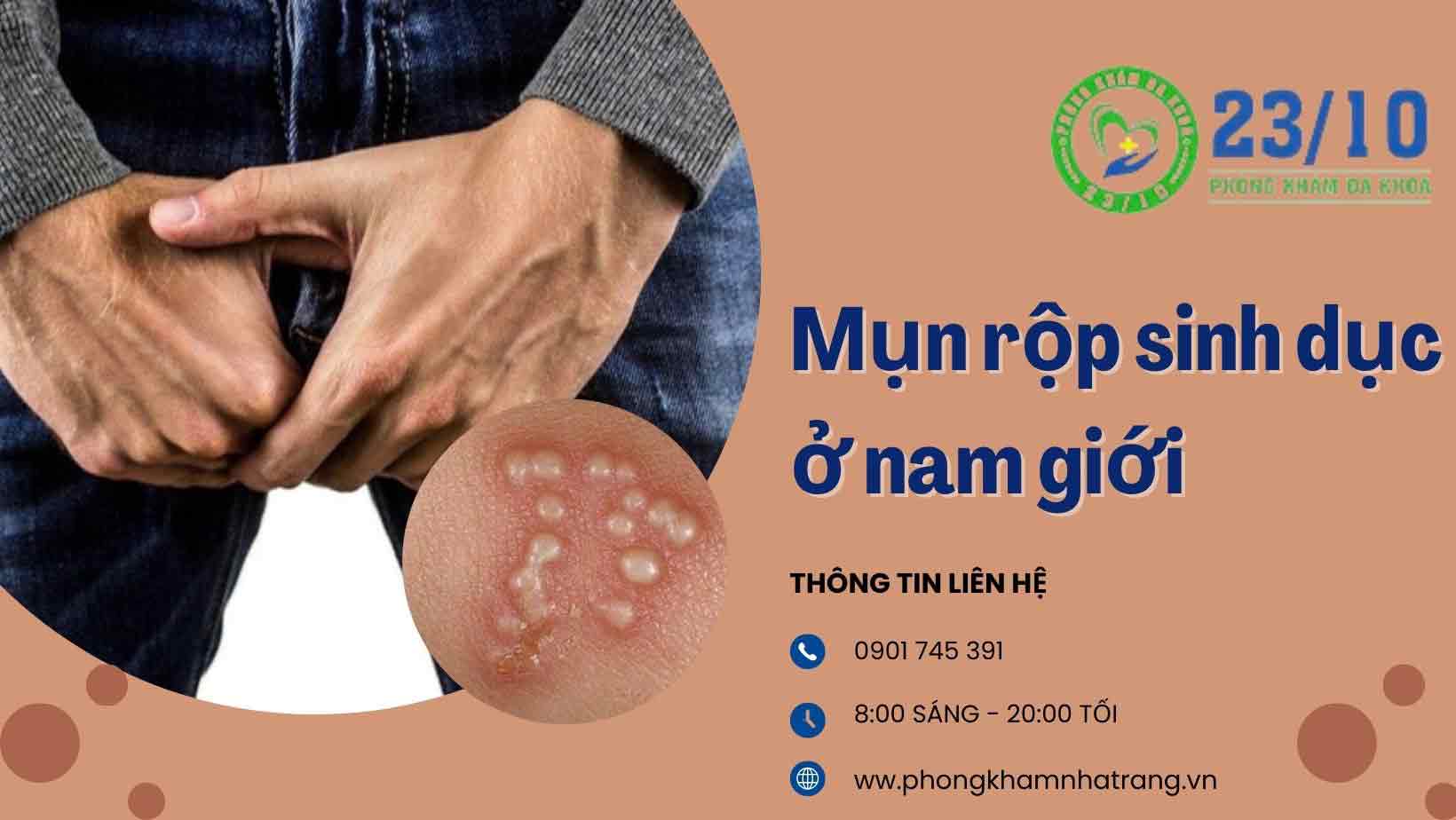 Biểu hiện mụn rộp sinh dục nam giai đoạn đầu