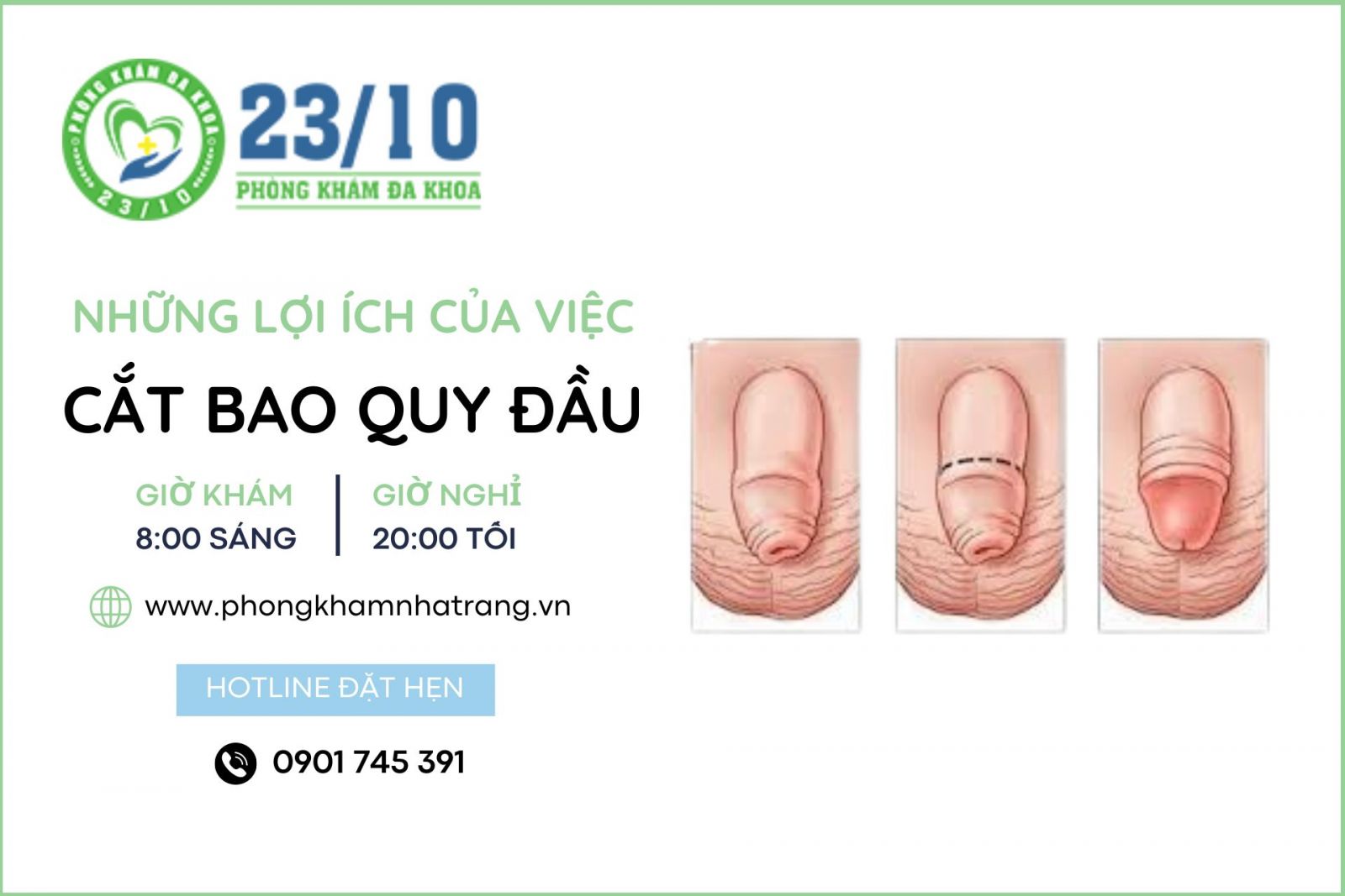 cắt bao quy đầu để làm gì