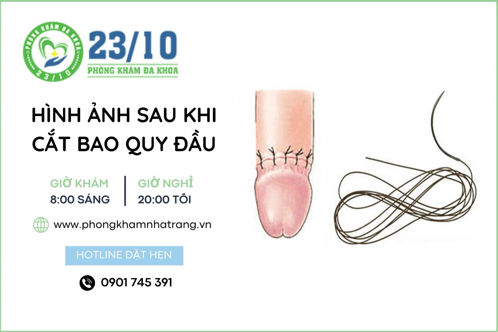 hình ảnh của bao quy đầu sau khi được cắt thành công