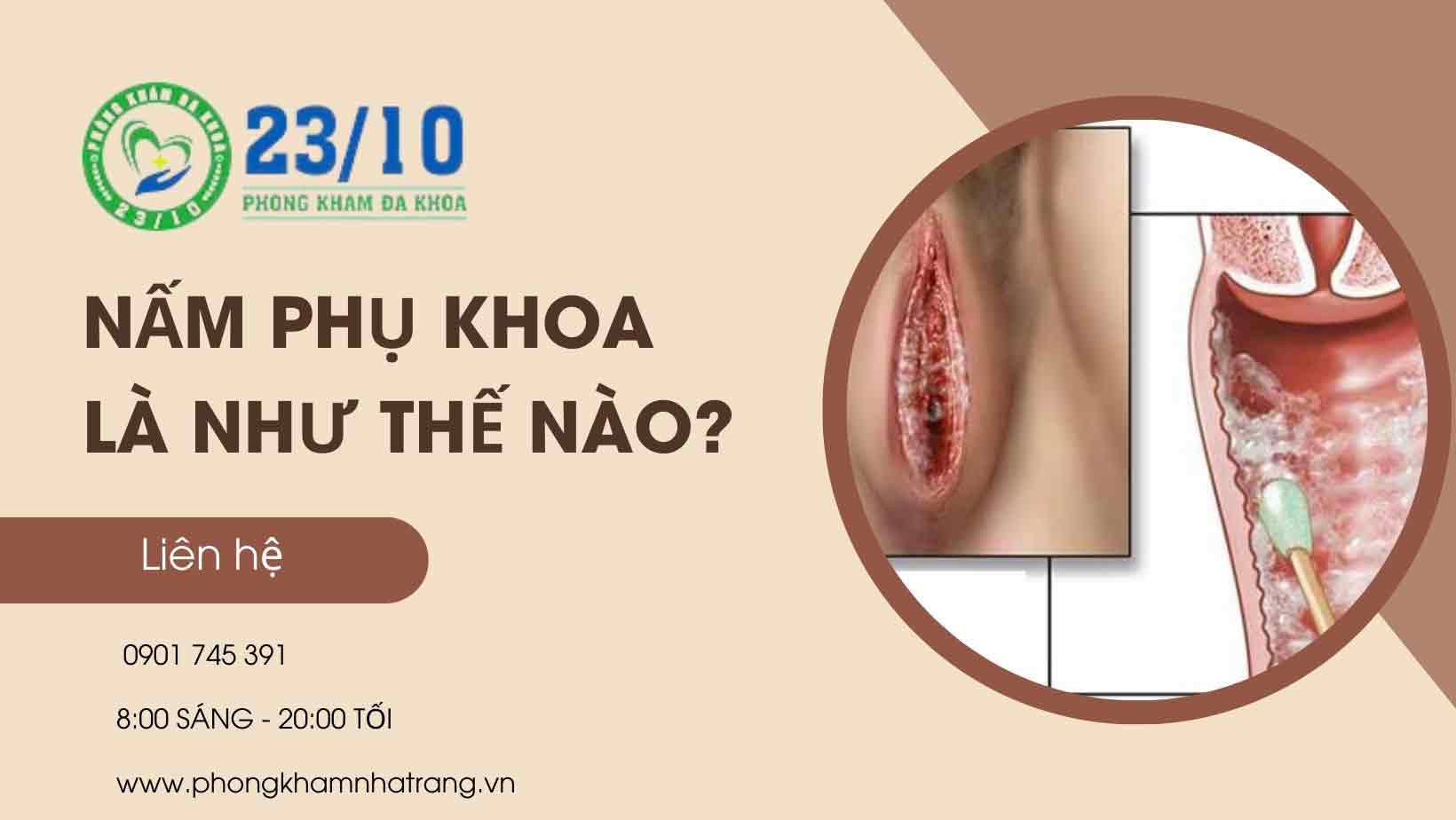 Nguyên nhân gây ra nấm phụ khoa