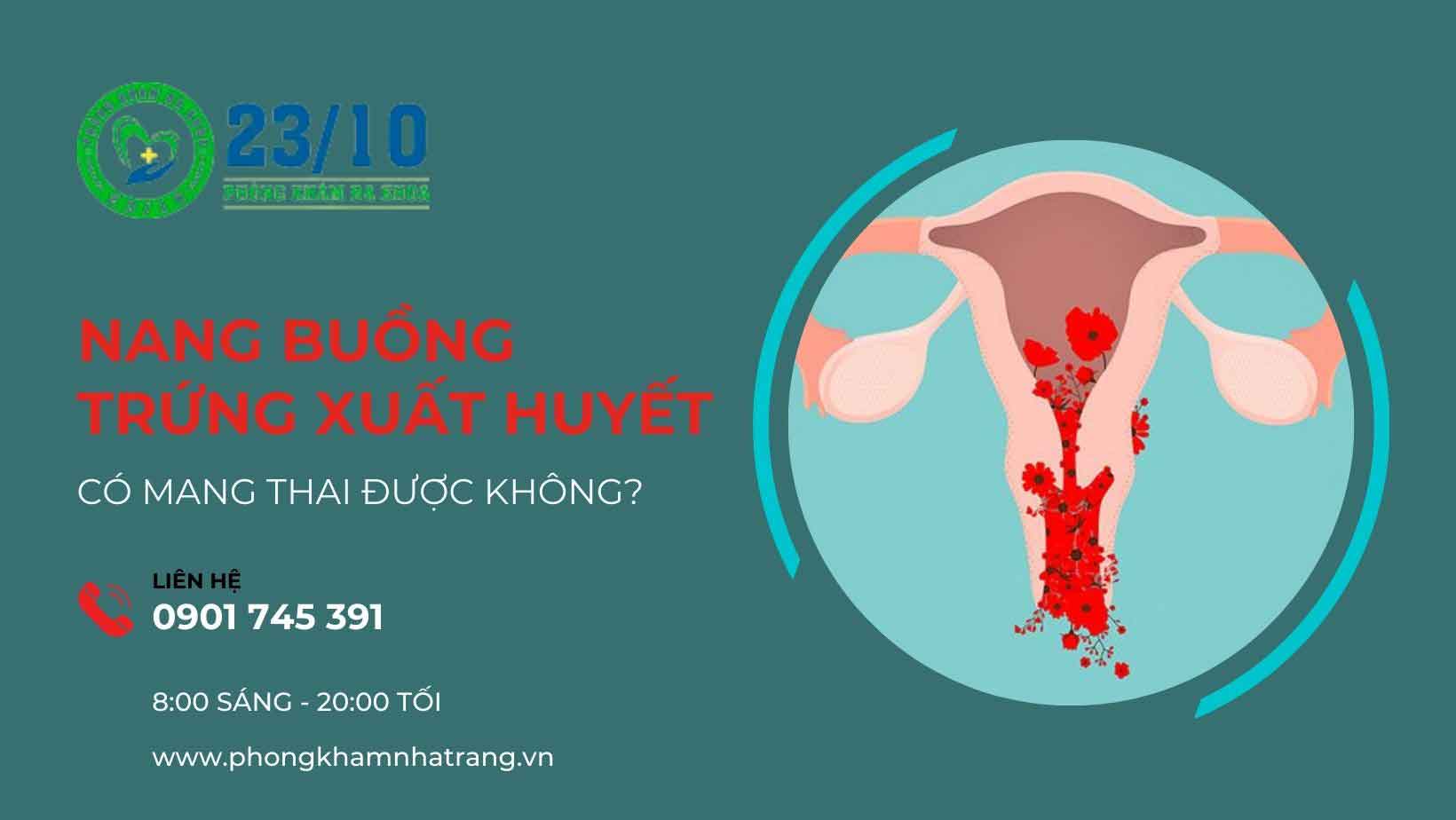 Xuất huyết nang buồng trứng trái là gì?