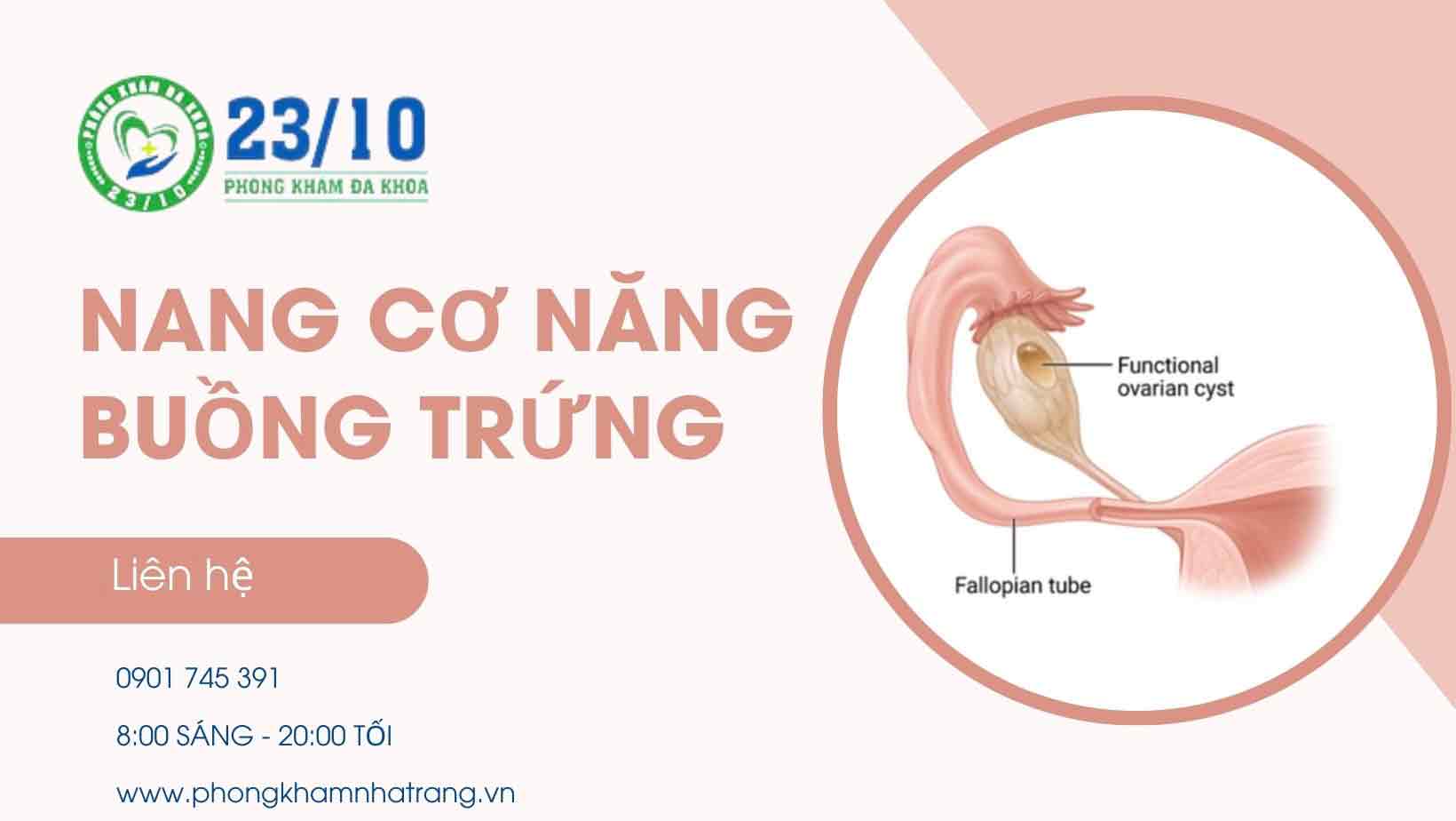 Nang cơ năng buồng trứng là gì? 