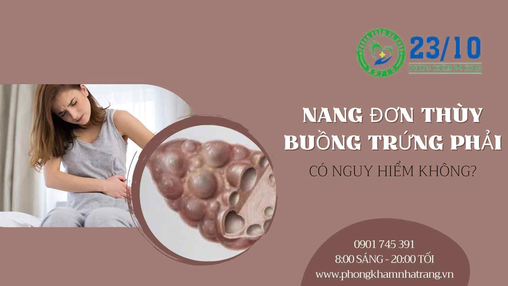 Nang đơn thùy buồng trứng phải là gì?